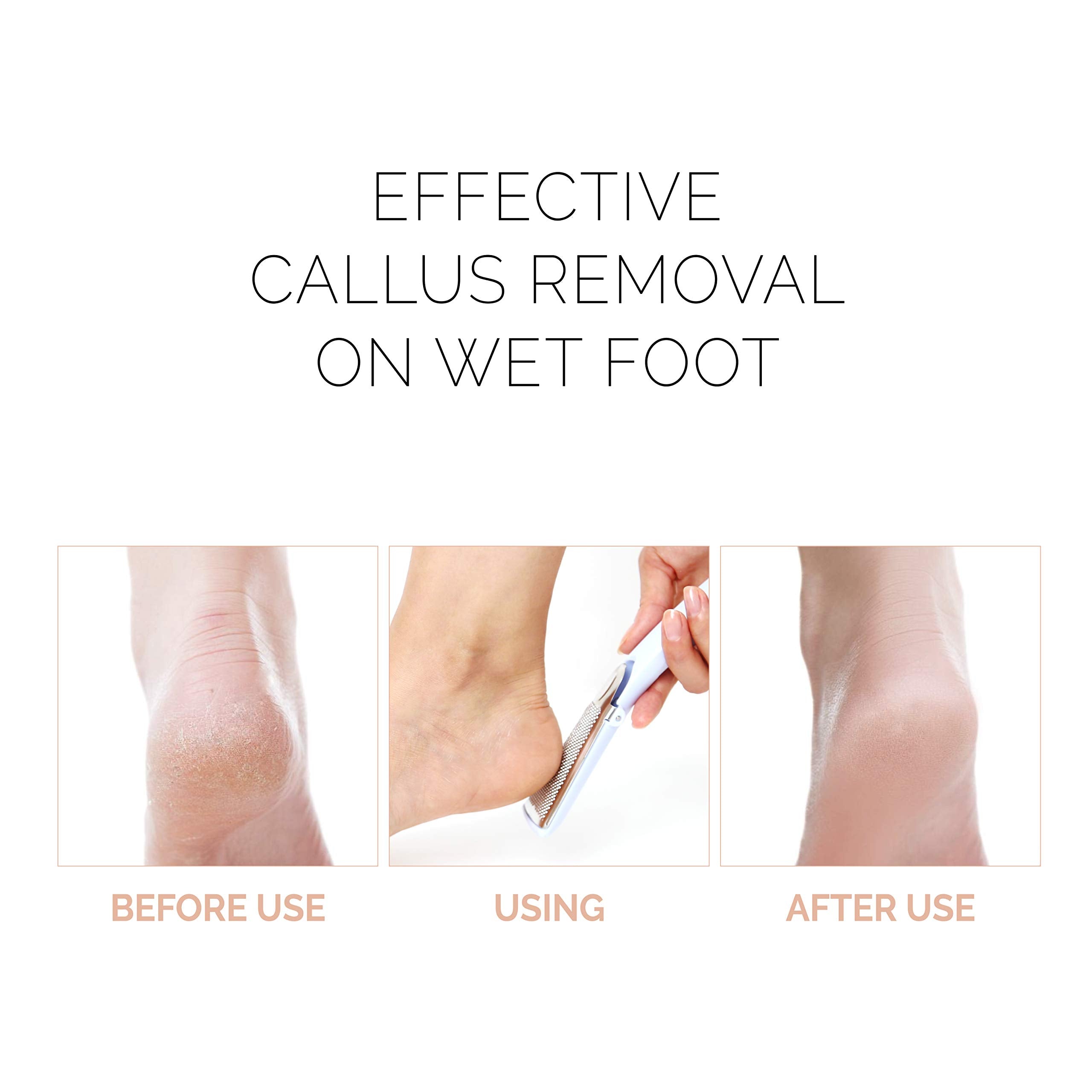F3 Systems, Stainless Steel Callus Remover, Effective For Thick Callus And Cracked Feet Pedicure Rasp, Remove Hard Skin, Grater