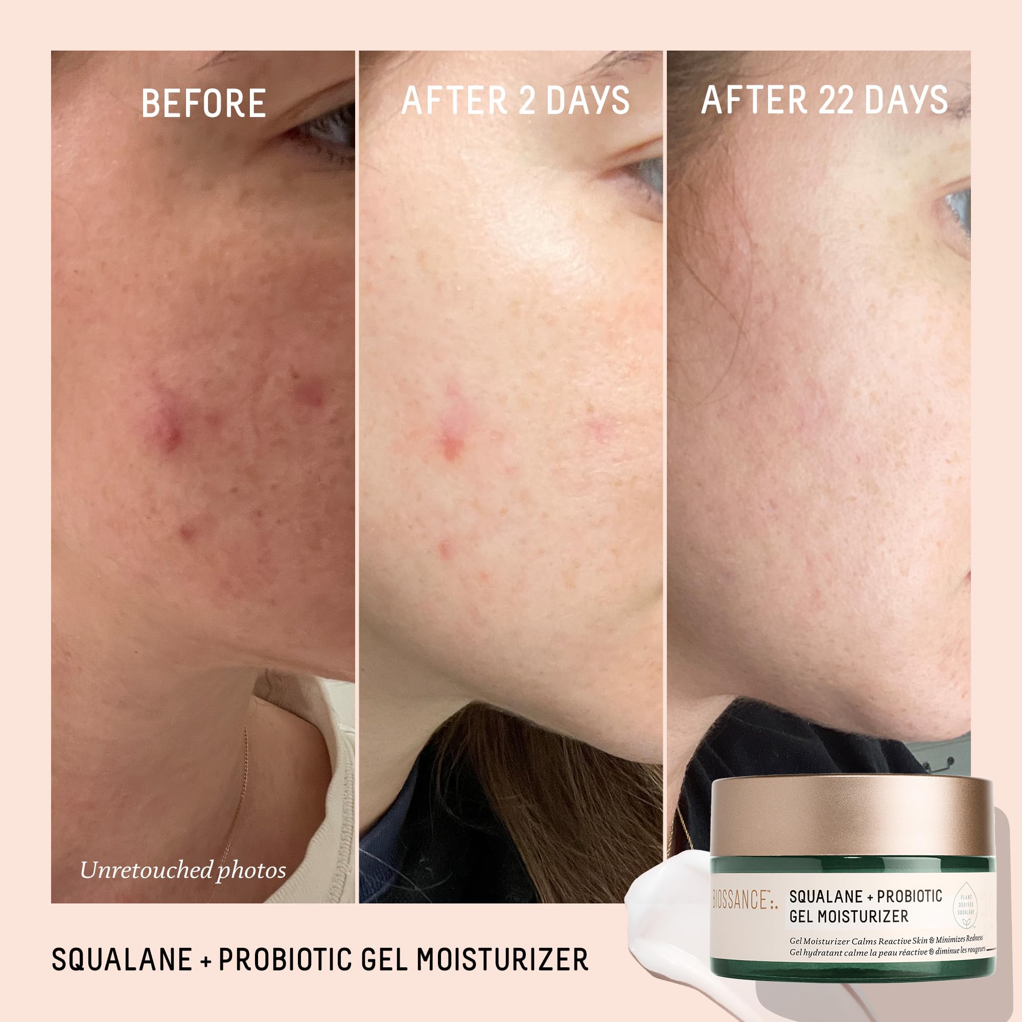 Biossance Squalane + Probiotic Balancing Gel Moisturizer 1.69 oz / 50 mL