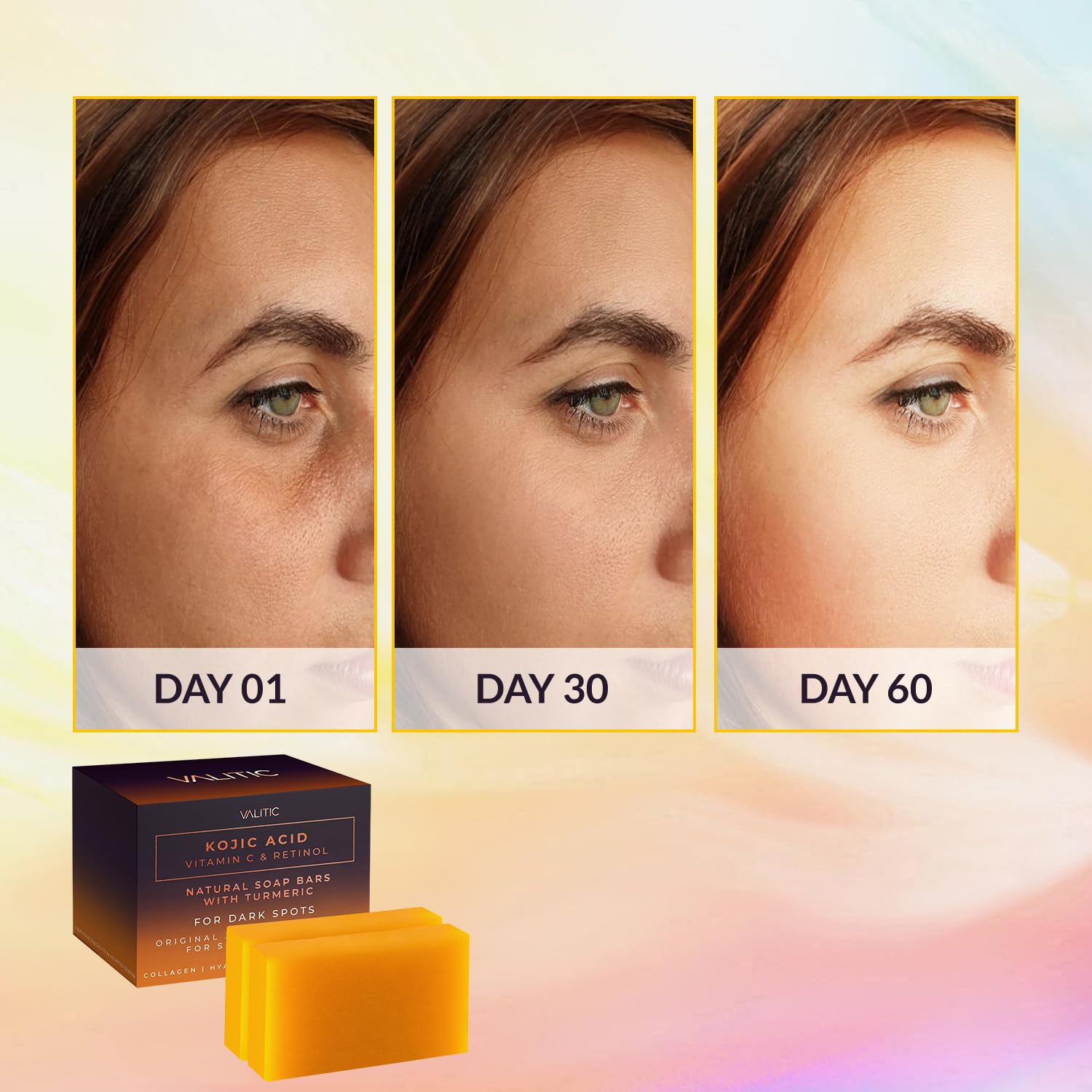 Valitic Kojic Acid Vitamin C And Retinol Soap Bars With Turmeric For Dark Spot - Original Japanese Complex With Collagen, Hyalur