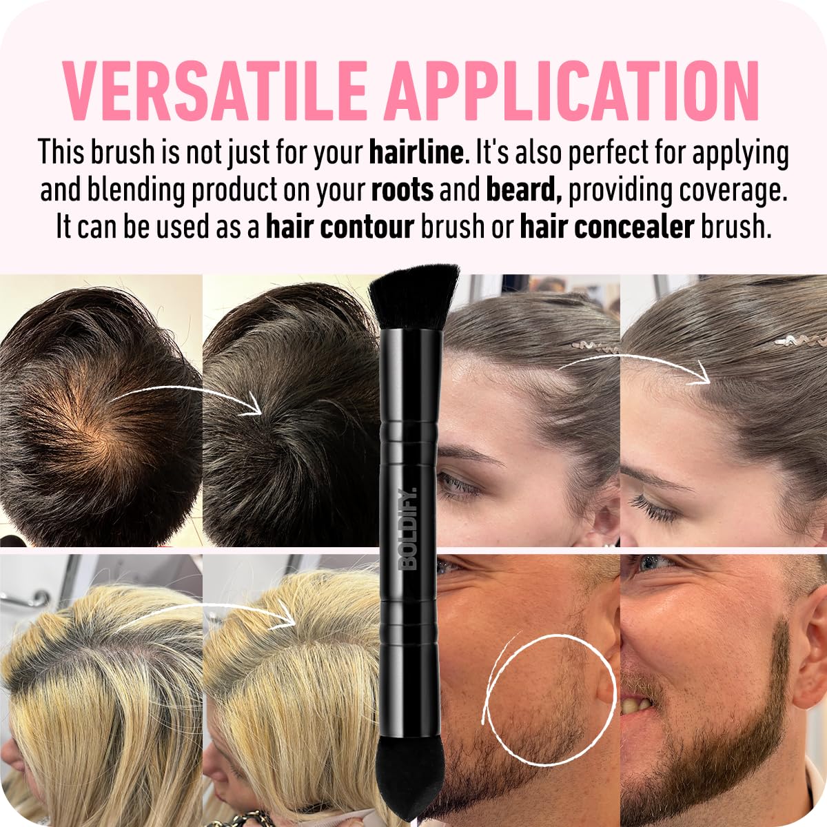 Boldify Dual-Ended Hairline Powder Brush - Precision Makeup Brush Set With Sponge Tip For Seamless Blending - Ideal As A Conceal