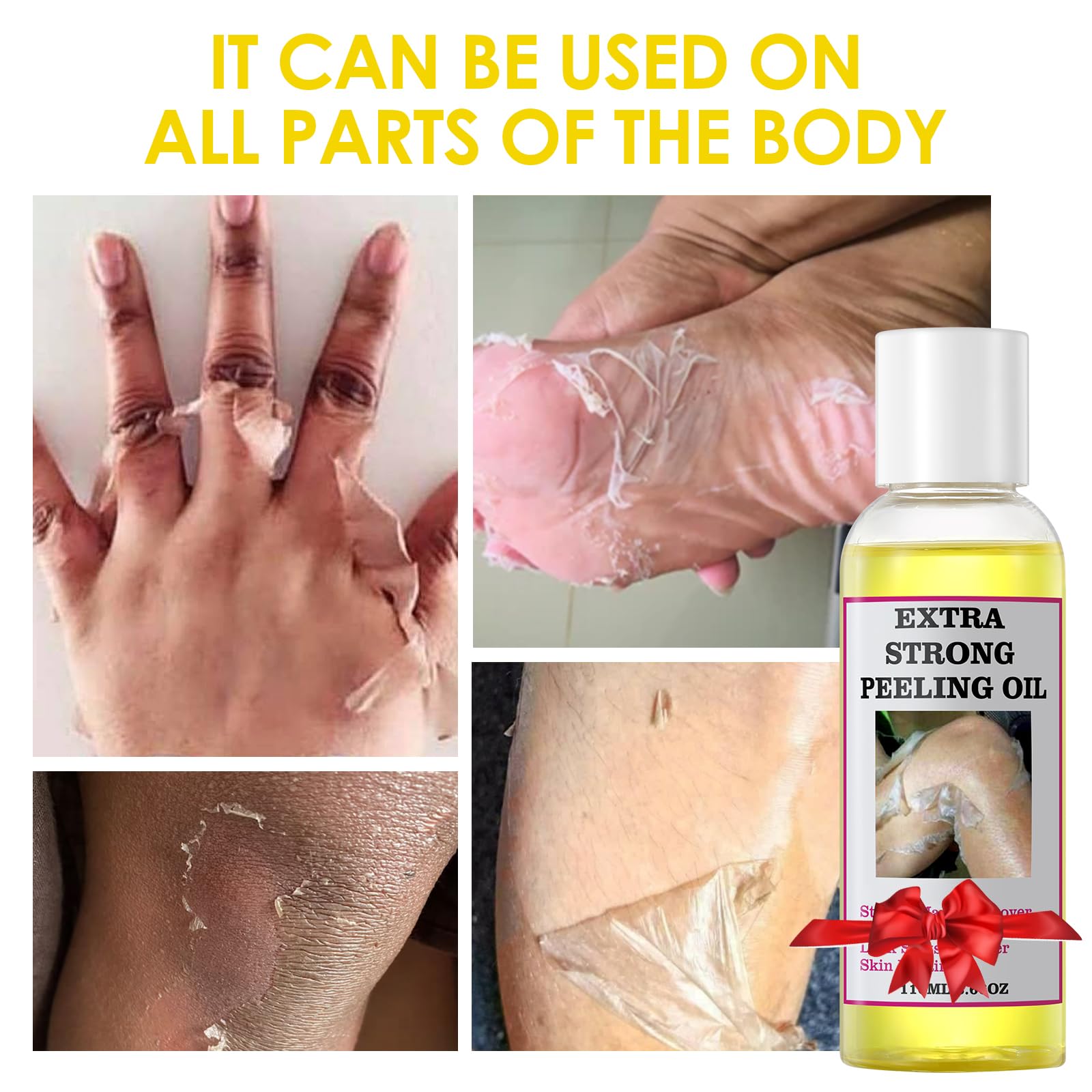 Peeling Oil For Dark Skin, Yellow Peeling Oil, Strong Peeling Oil Extra Strength, Exfoliating Peeling Solution For Body All Skin
