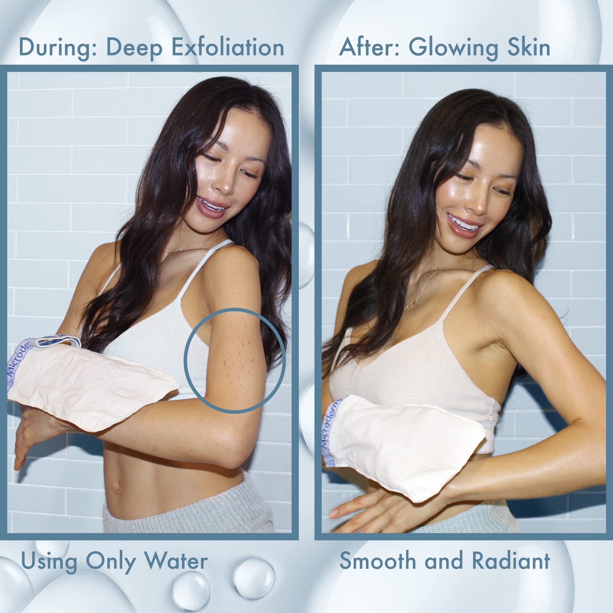 Microdermamitt Deep Exfoliating Mitt For Shower - Dead Skin Remover & Exfoliator Body Scrubber - Keratosis Pilaris - Premium Qua
