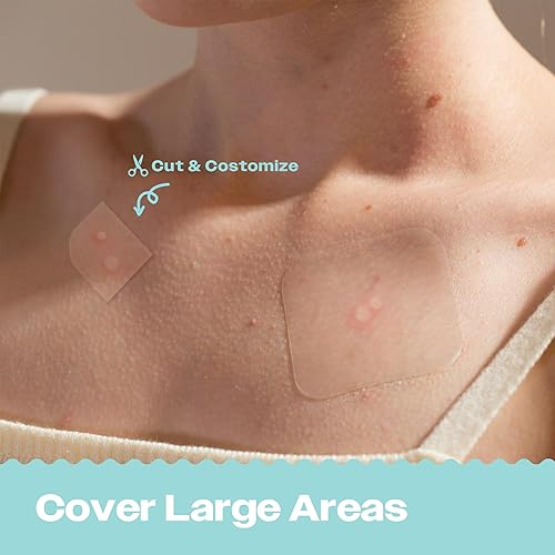 AVARELLE Acne Patches XL - Large Hydrocolloid Treatment with Tea Tree, Calendula & Cica - 8 Count for Face, Cheek & Nose