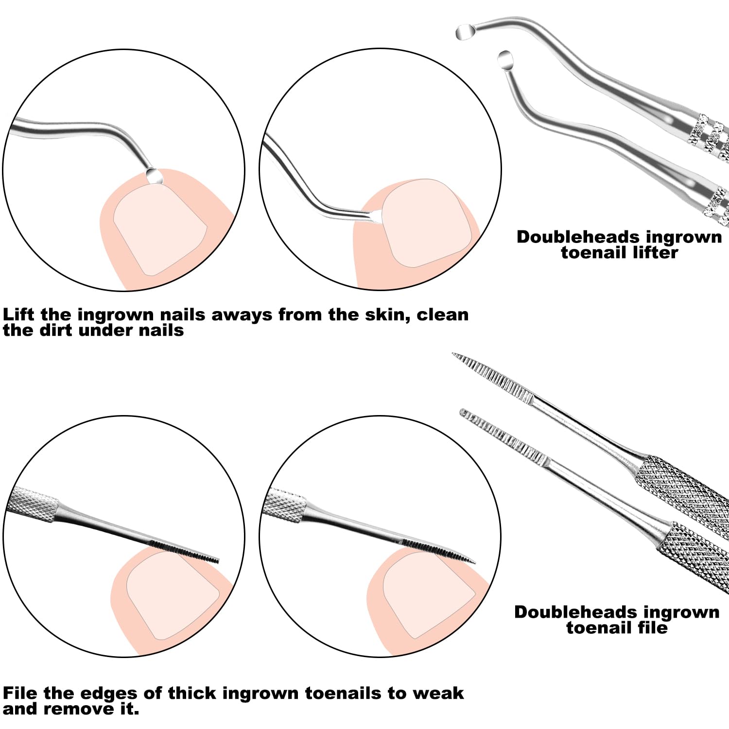 ZIZZON 7 Pcs Ingrown Toenail File and Lifters Set, Stainless Steel Ingrown Toenail Removal Kit, Manicure Treatment Under Nail Cl