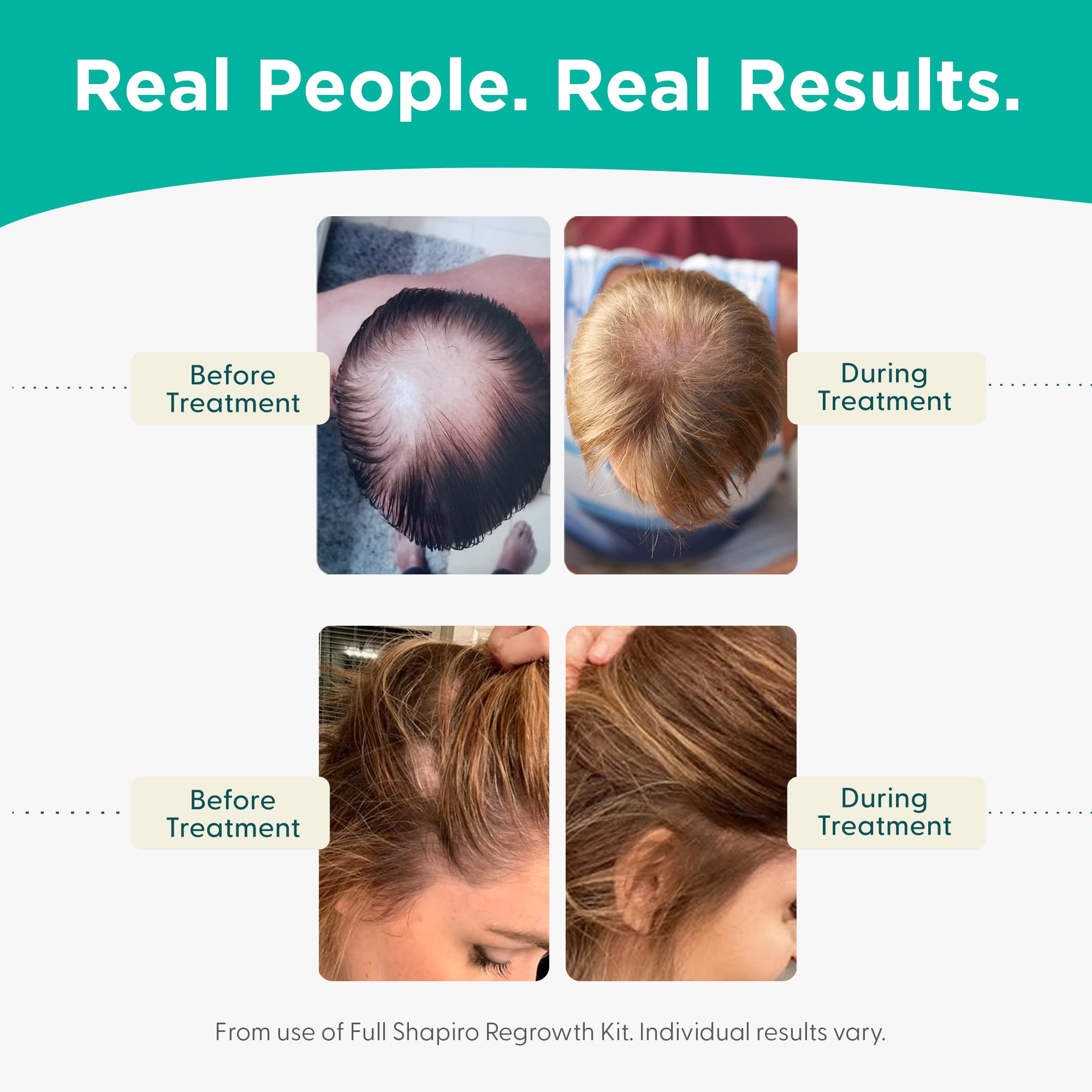 Shapiro Md Hair Growth Experts Hair Loss Conditioner, Dht Fighting Vegan Formula For Thinning Hair Developed By Dermatologists,