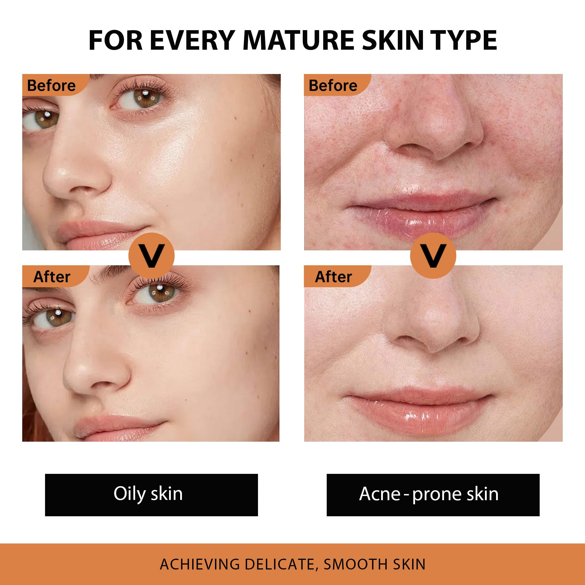 Vgo Retinol Serum For Face - Anti-Aging & Hydration Powerhouse For A Firmer, Youthful Glow - Ideal For Acne-Prone & Oily Skin, T