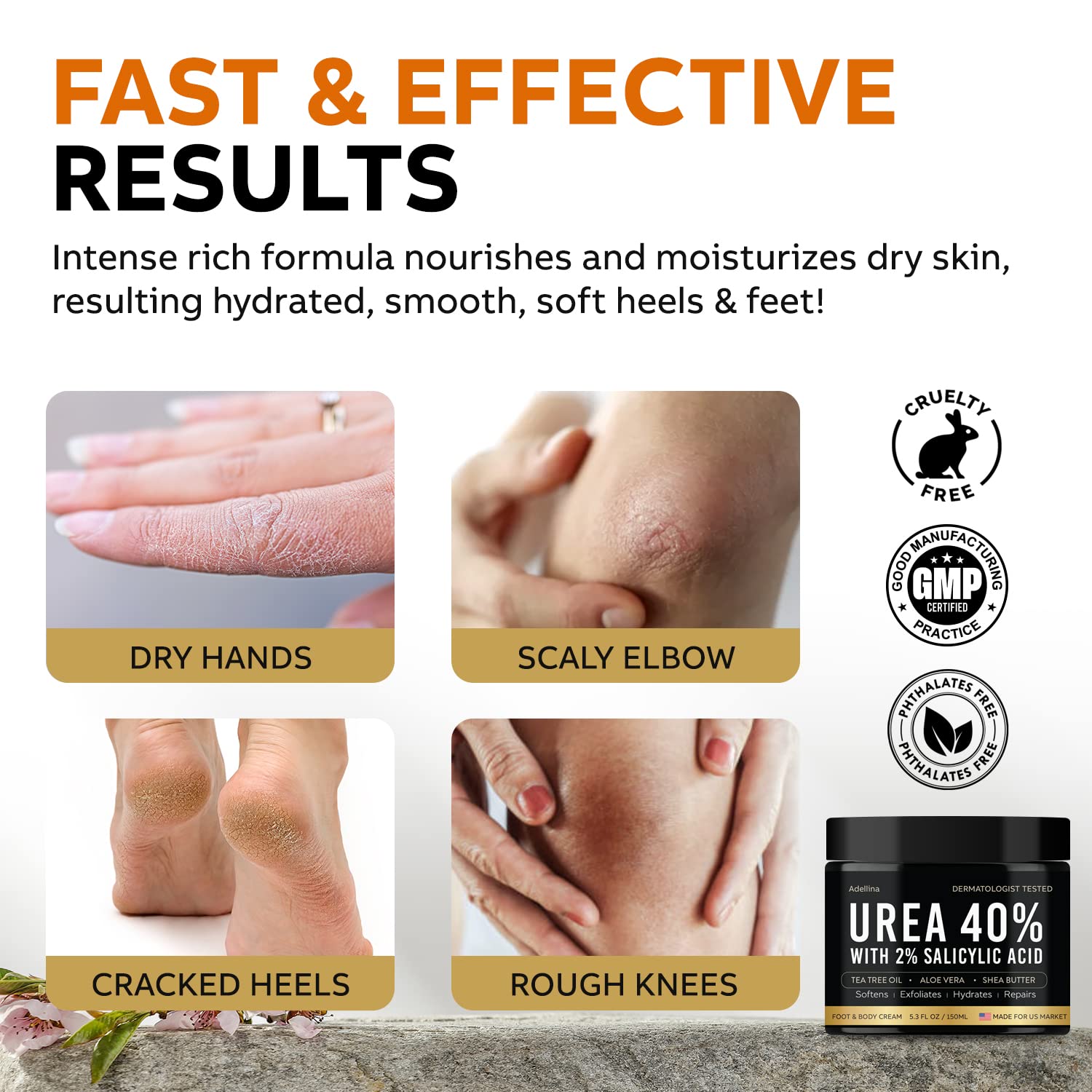Adellina Urea Foot Cream 40% - Maximum Strength for Dry Cracked Heels, 5.3 Fl Oz, Model ADL-40