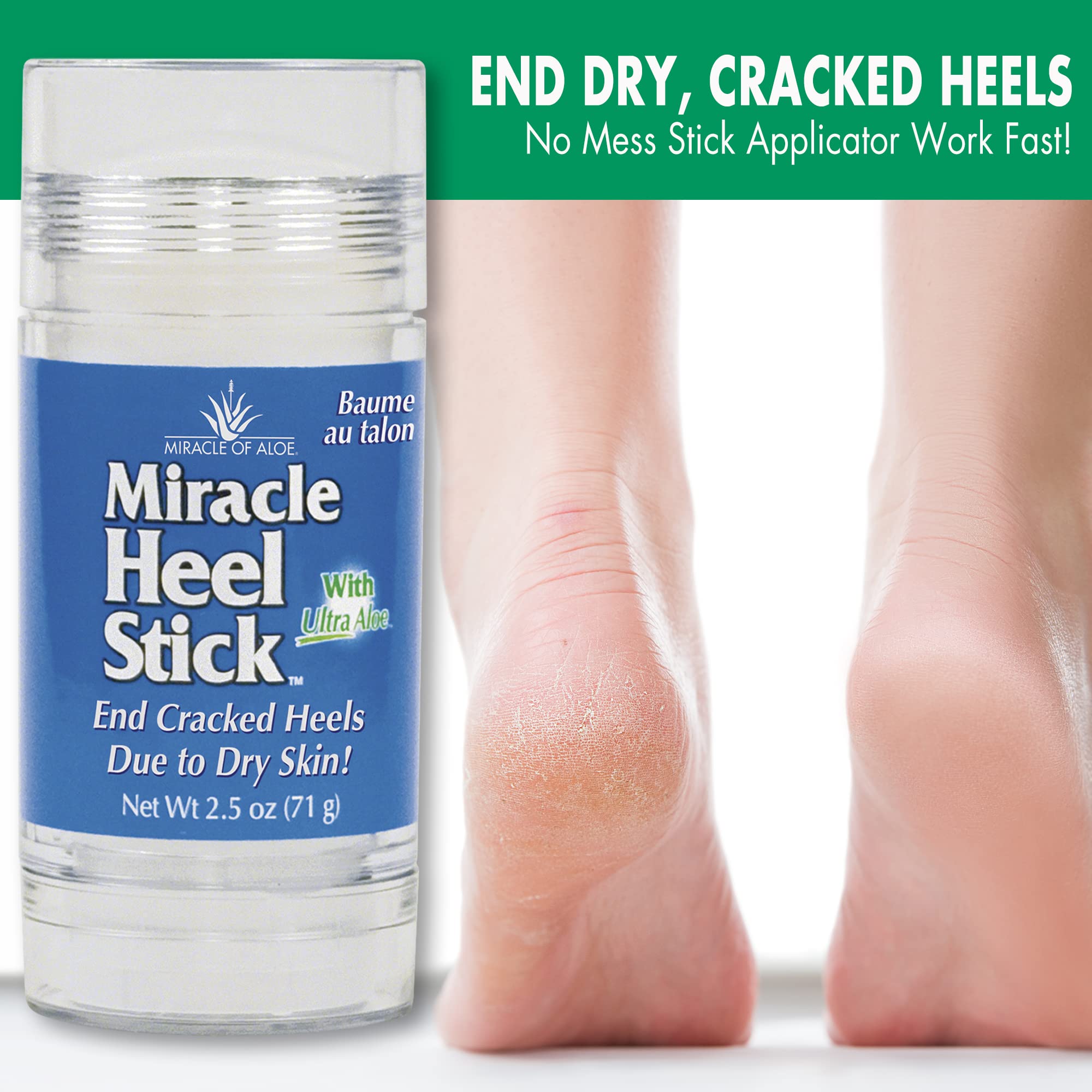 Miracle Of Aloes Miracle Heel Stick - Quick Relief For Rough, Dry, Cracked Heels - Intensive Therapeutic Balm For Severe Dry Fee