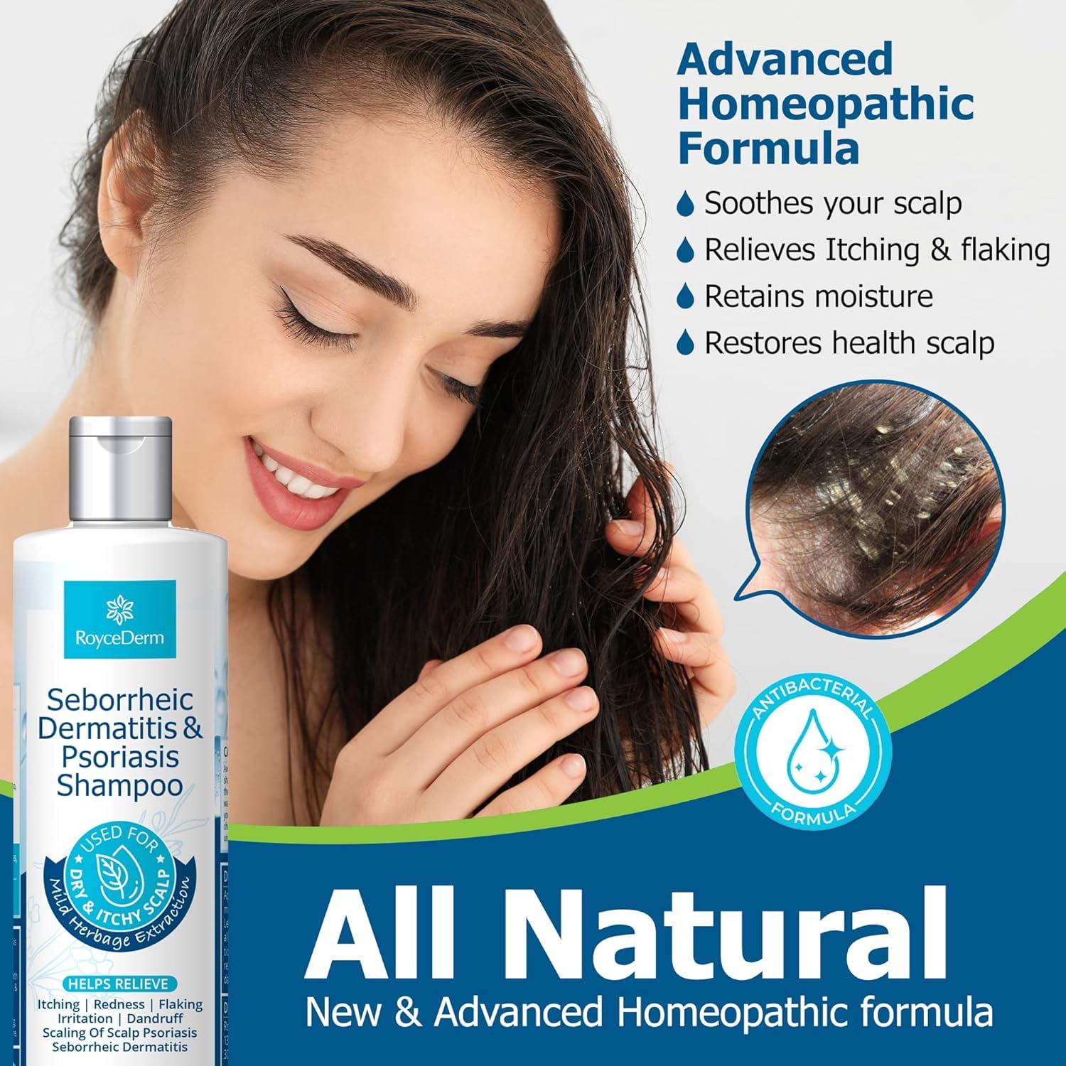 Roycederm Psoriasis Shampoo, Seborrheic Dermatitis Shampoo, Folliculitis Shampoo, Dandruff Shampoo, Scalp Psoriasis & Seborrheic