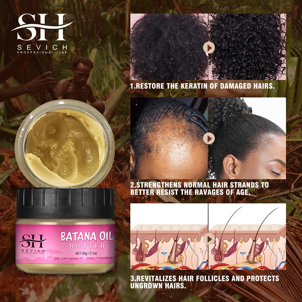 SEVICH Hair Butter with 100% Pure Raw Batana Oil - From Honduras for Growth, Repairing Damaged Tresses, Nourishing Thin Scalp an
