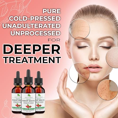 Jeune Naturelle Rosehip Oil Organic, From Fruit & Seeds, Pure, Raw, Virgin, Cold Pressed, Undiluted Body Oil For Skin Care, For