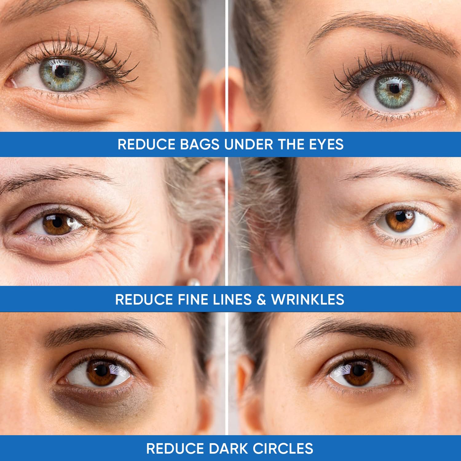 Under Eye Puffiness & Dark Circles Rapid Treatment- Instantly Reduces The Appearance Of Puffy Eye Bags, Crows Feet, & Sagging Sk