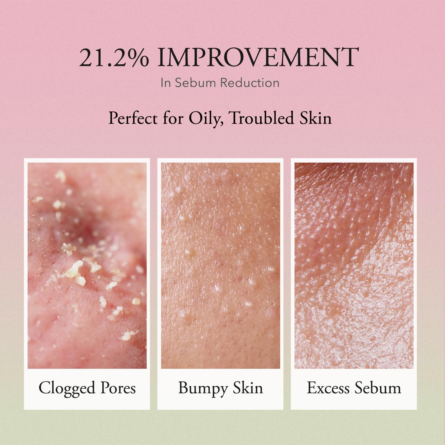 Aprilskin Pink Aloe Vita Toner | Calms And Soothes Redness, Smoothens, And Controls Excess Sebum | 80% Pink Aloe Vera Water | Hy
