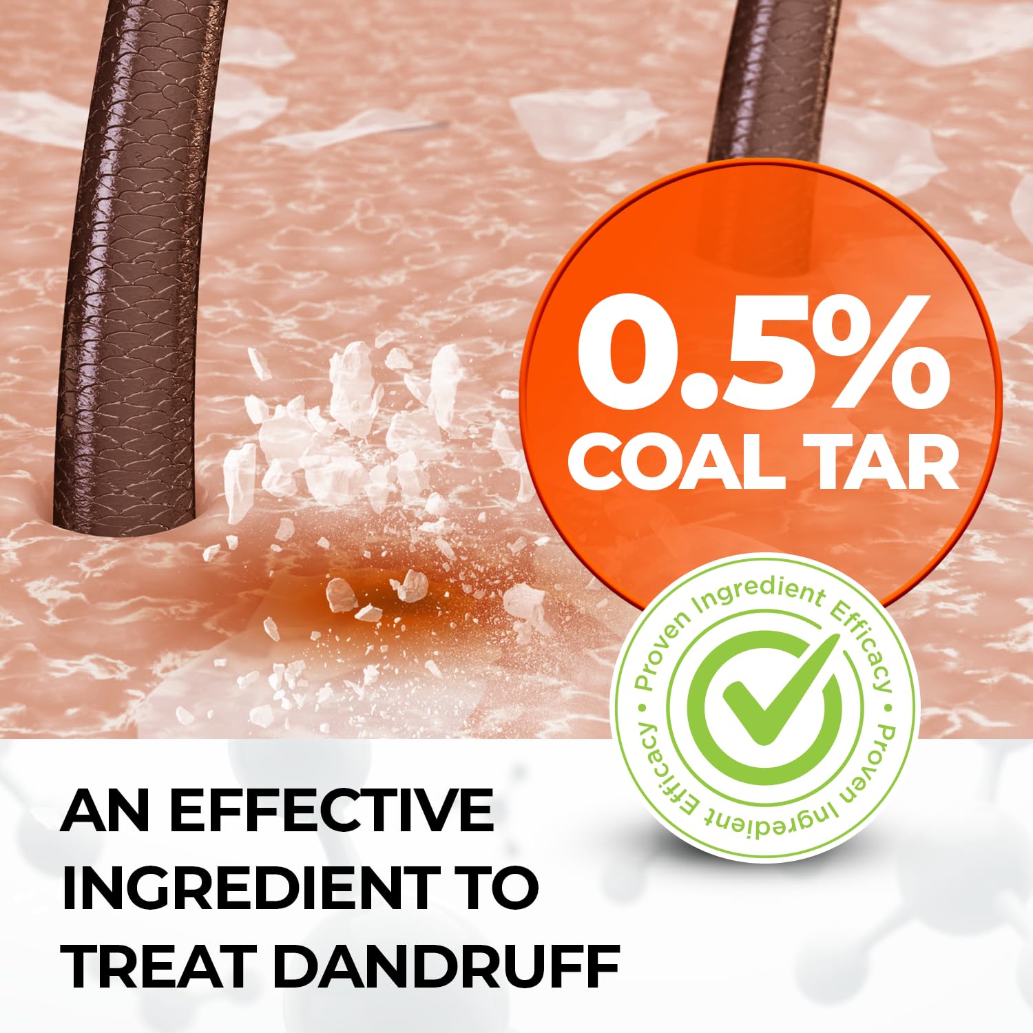 Medicasp Coal Tar Gel Dandruff Shampoo To Treat Seborrheic Dermatitis Psoriasis, 6 Ounce (Pack Of 1)