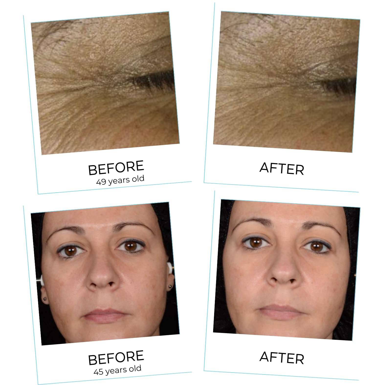 Yunasence YOGA SKIN Oxygenating Neuroactive Wellness Cream, with Antioxidants, Vitamins B. C. D. E.