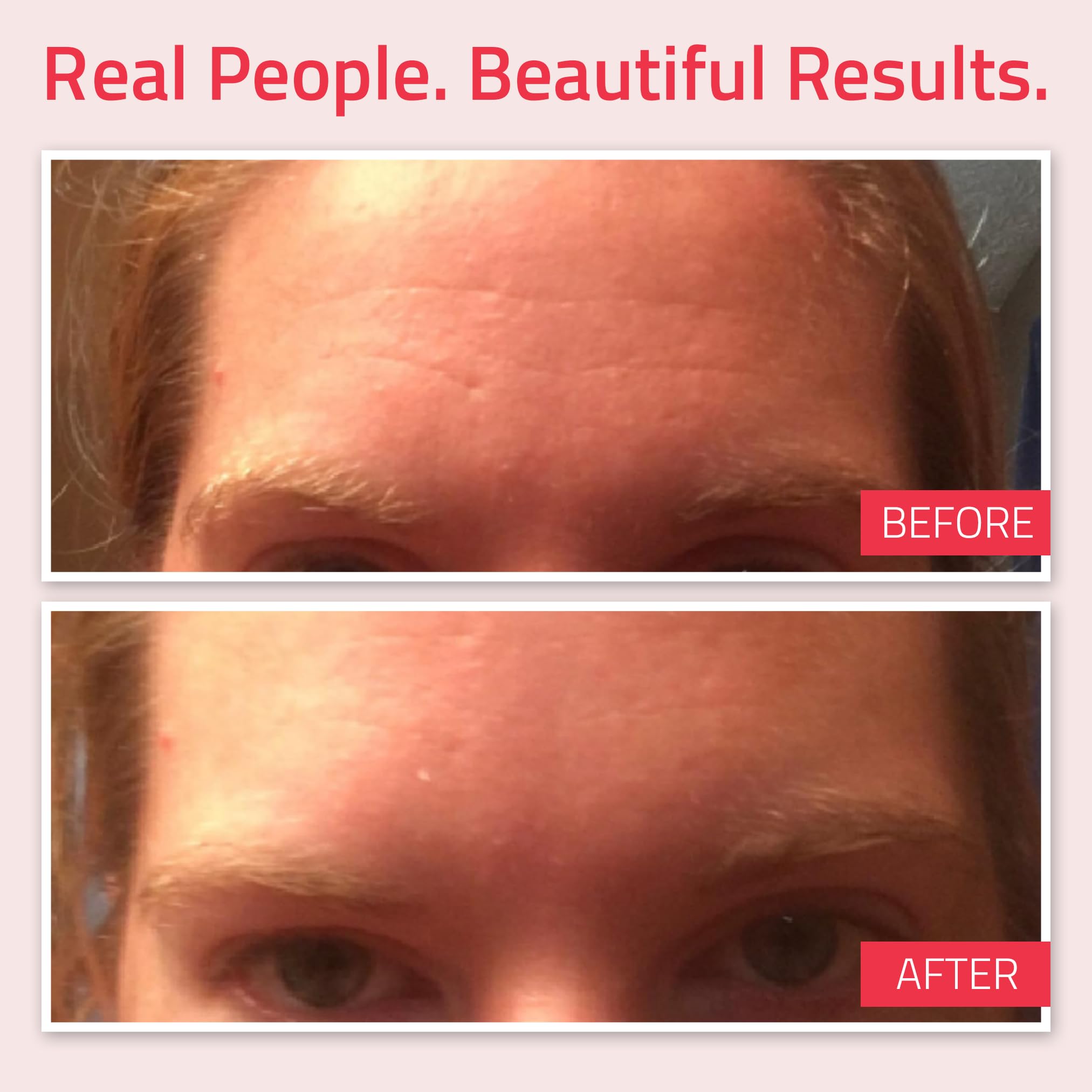 YEOUTH Retinol Serum for Face with Hyaluronic Acid, Hydrating Night Serum for Face, Retinol for Acne, Wrinkle & Dark Spots, Anti