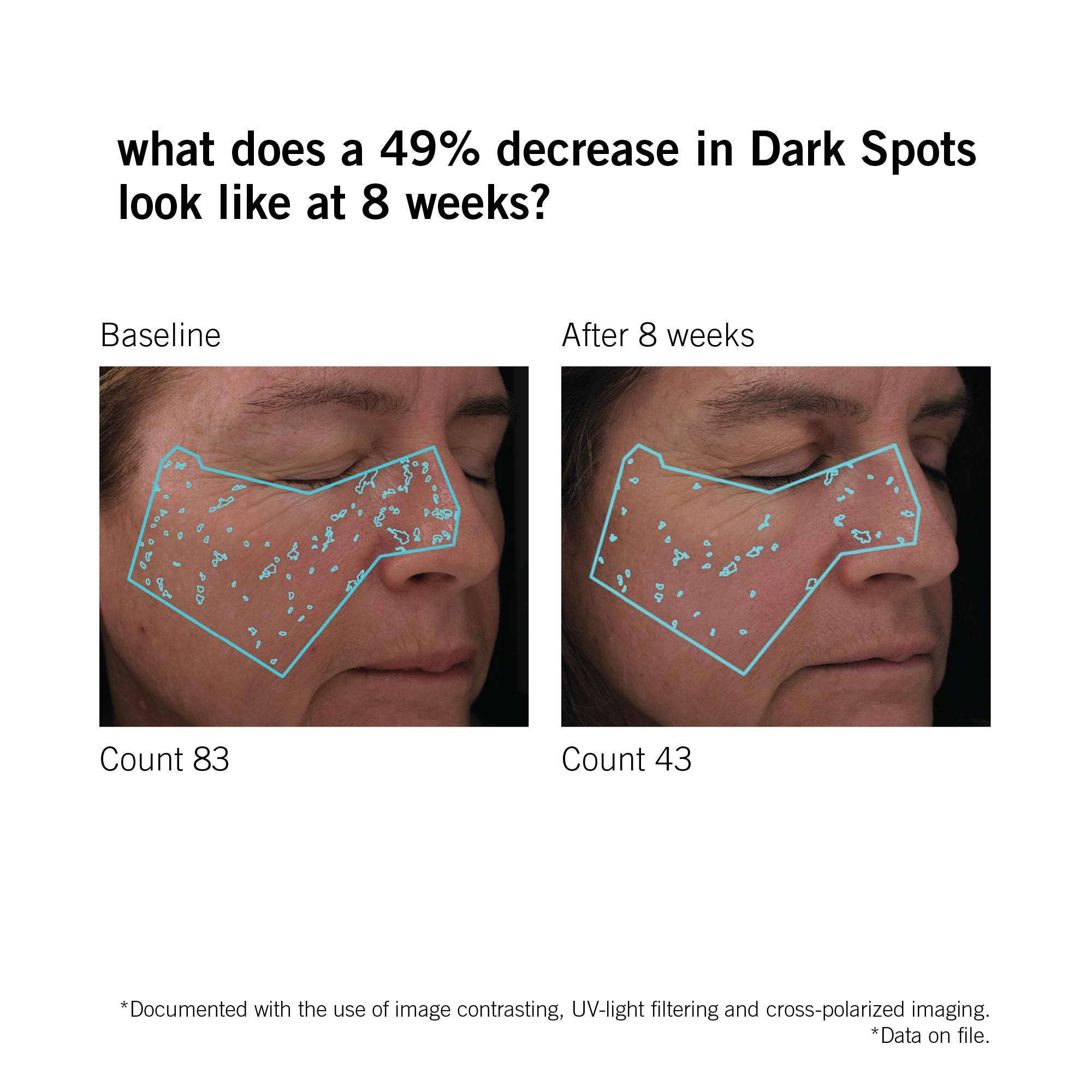 Neova Smartskincare Dna Total Repair Serum 30 Ml, 1 Fl Oz  Reduces Wrinkles, Uneven Texture, & Hyperpigmentation  Sun Damage Rep