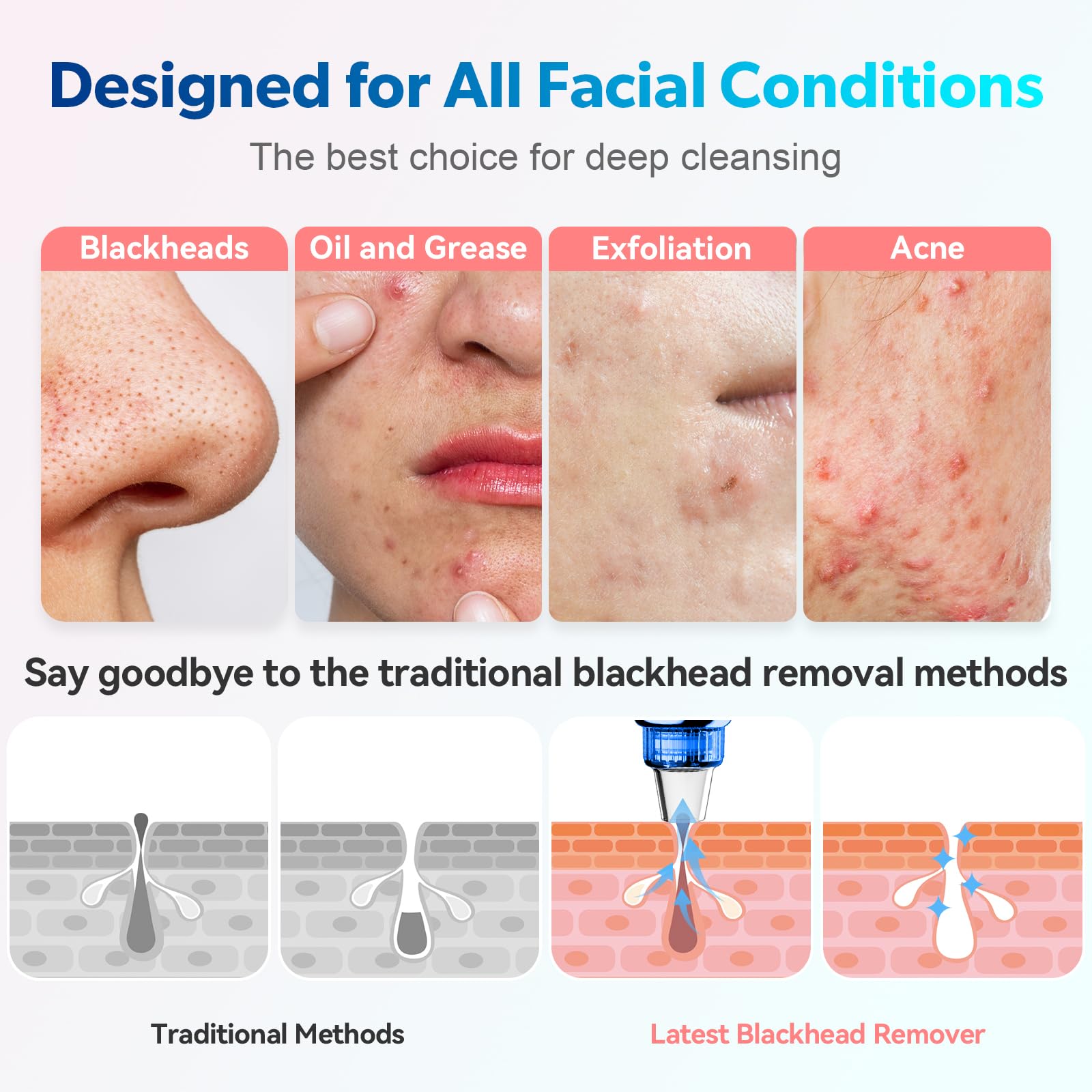 Blackhead Remover Pore Vacuum Upgraded Facial Pore Cleaner Electric Comedone Whitehead Extractor Tool-5 Suction Power,5 Probes,U