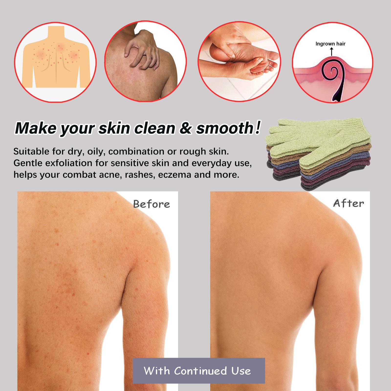 Mig4U Shower Exfoliating Scrub Gloves Medium To Heavy Bathing Gloves Body Wash Dead Skin Removal Deep Cleansing Mitts For Women