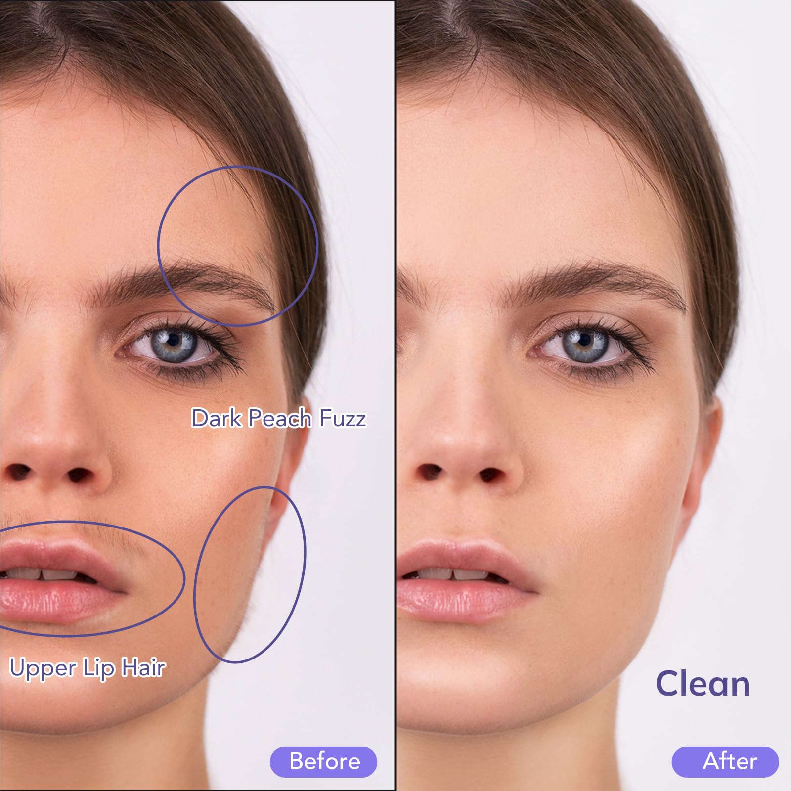 Pelcas Electric Dermaplaning Tool With Led Light, Mini Face Dermaplaning Razor, Painless 3 Speeds Facial Peach Fuzz, Exfoliation