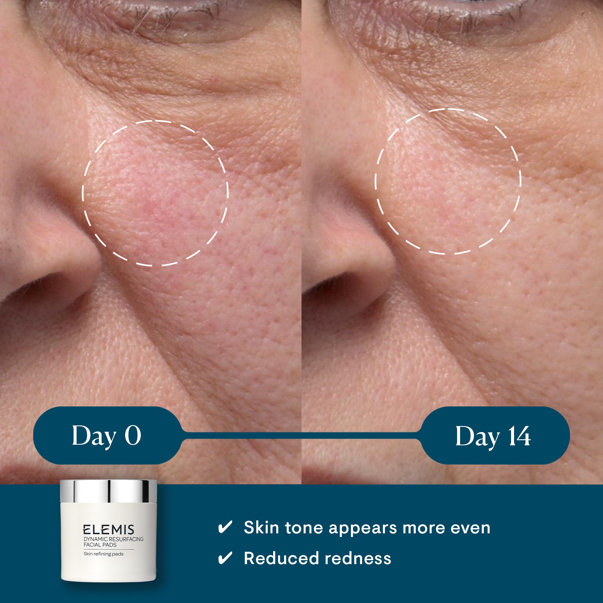 ELEMIS Dynamic Resurfacing Exfoliating Pads, 60 Count, Chemical Peel Toner, White, Model 50053