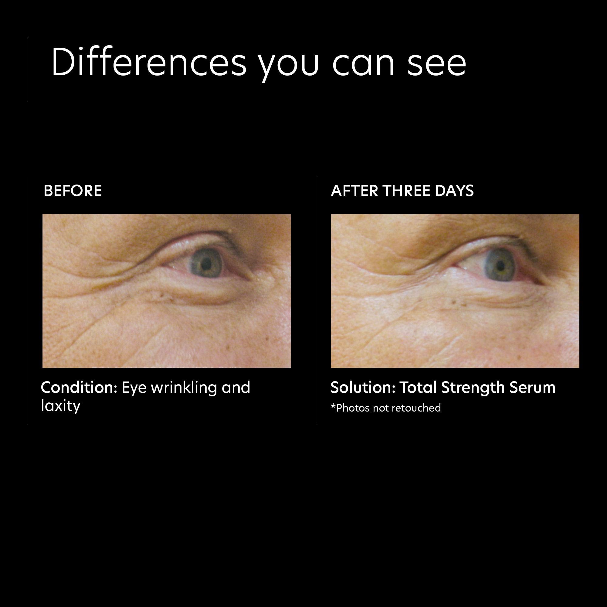 Pca Skin Total Strength Anti Wrinkle Serum, Anti Aging Serum, Minimizes Fine Lines, Wrinkles, And Pores, 1.0 Fl Oz Pump