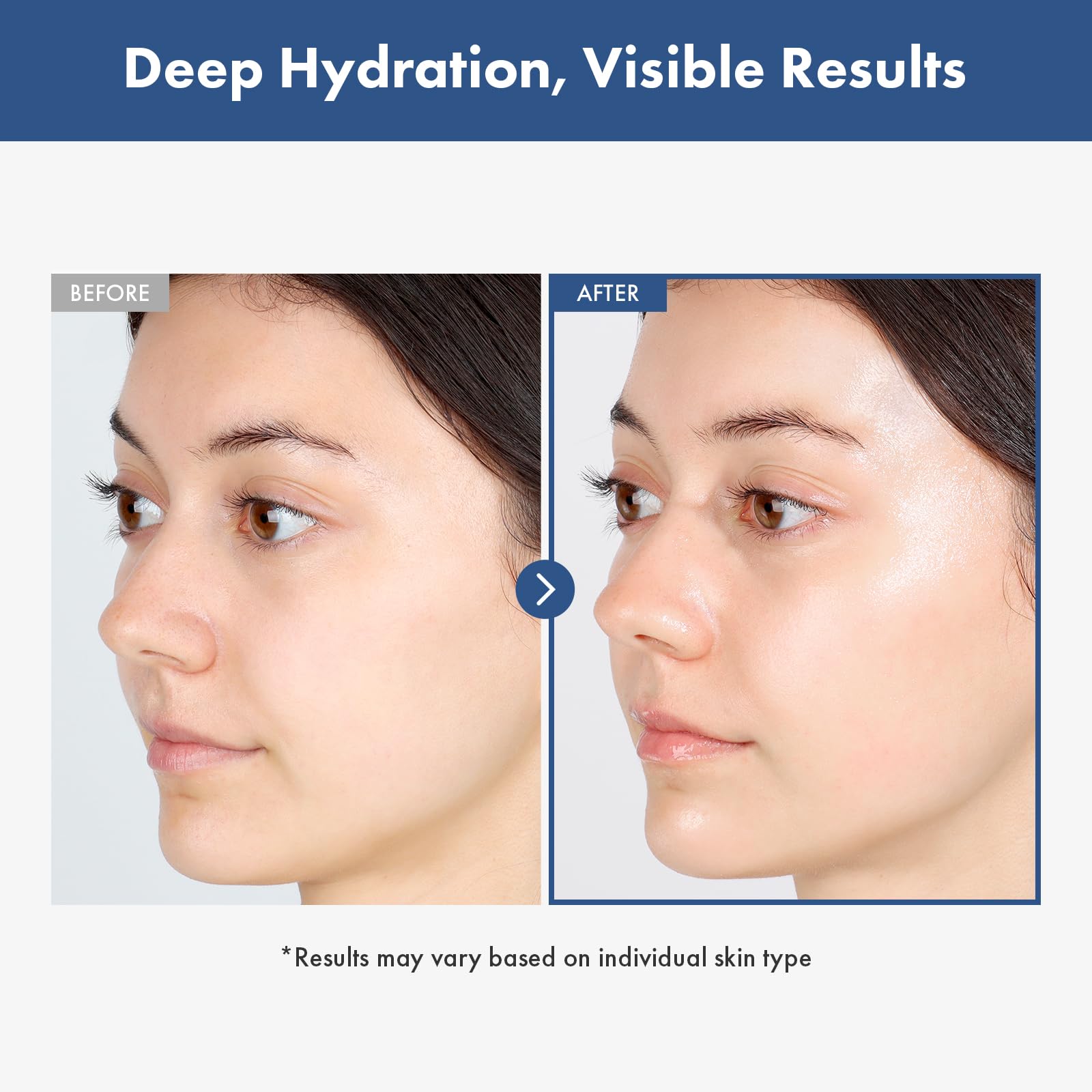 TOSOWOONG Hyaluronic Acid 3% Serum, 30,030ppm Sodium Hyaluronic Acid, Hydration, Moisture Boosting Facial Serum for Fine Lines &
