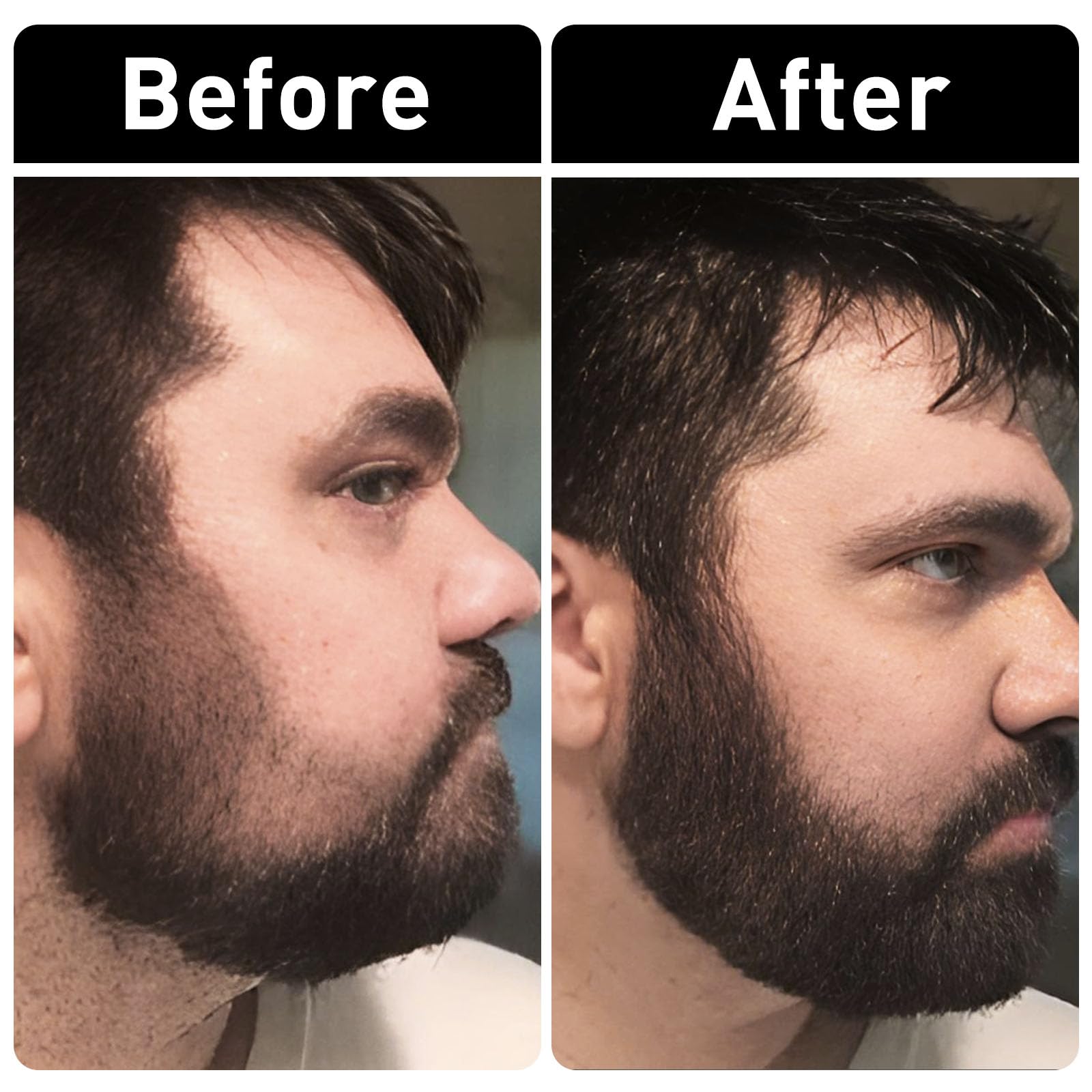 2Pcs Beard Pencil Filler For Men - Sweat Proof, Water Resistance, Long Lasting & Natural Finish Barber Pencil, Enhance Facial Ha