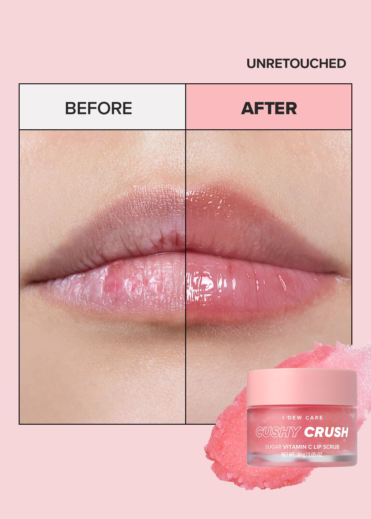 I DEW CARE Lip Scrub - Cushy Crush | Sugar Vitamin C, Lip Care, Lip Scrubber Exfoliator, Lip Exfoliator Scrub, Lip Care Products