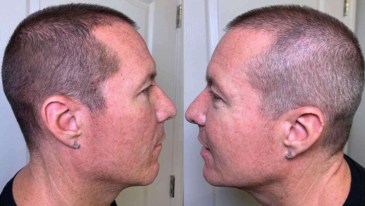 Thicken It 100% Scalp Coverage Hair Powder - Black - Talc-Free .32 Oz. Water Resistant Hair Loss Concealer For Men And Women. Na