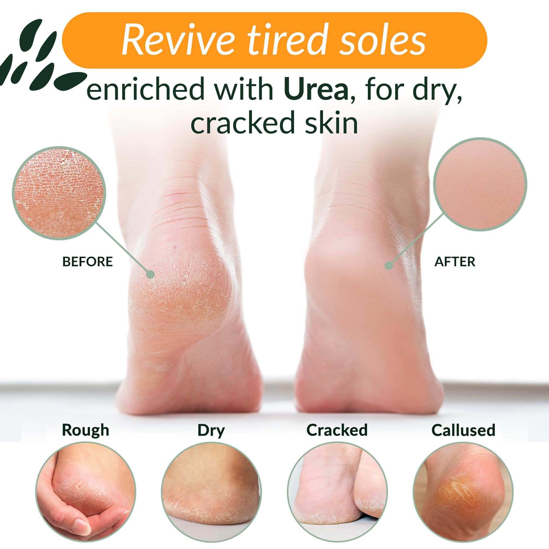 Tree To Tub Foot Cream For Dry Cracked Heels And Feet - Foot Lotion For Dry Cracked Feet, Non-Greasy Foot Moisturizer Urea Cream