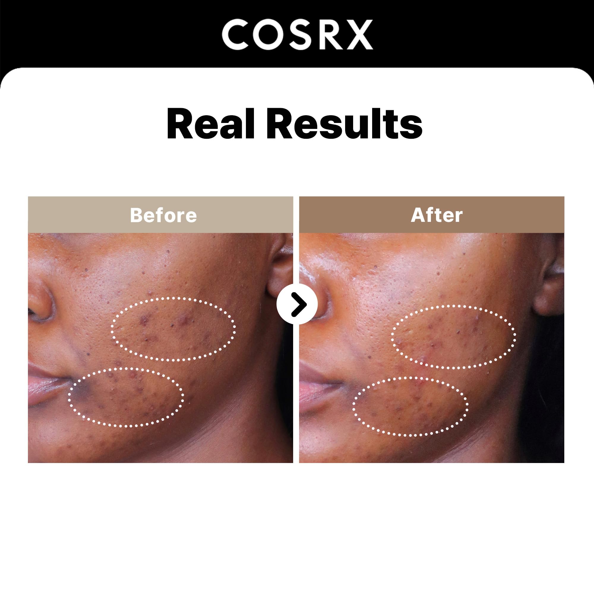 COSRX 2% Alpha Arbutin Discoloration Care Face Serum with Niacinamide, Glutathione & Tranexamic Acid, 1.7 fl oz - Serum for Face
