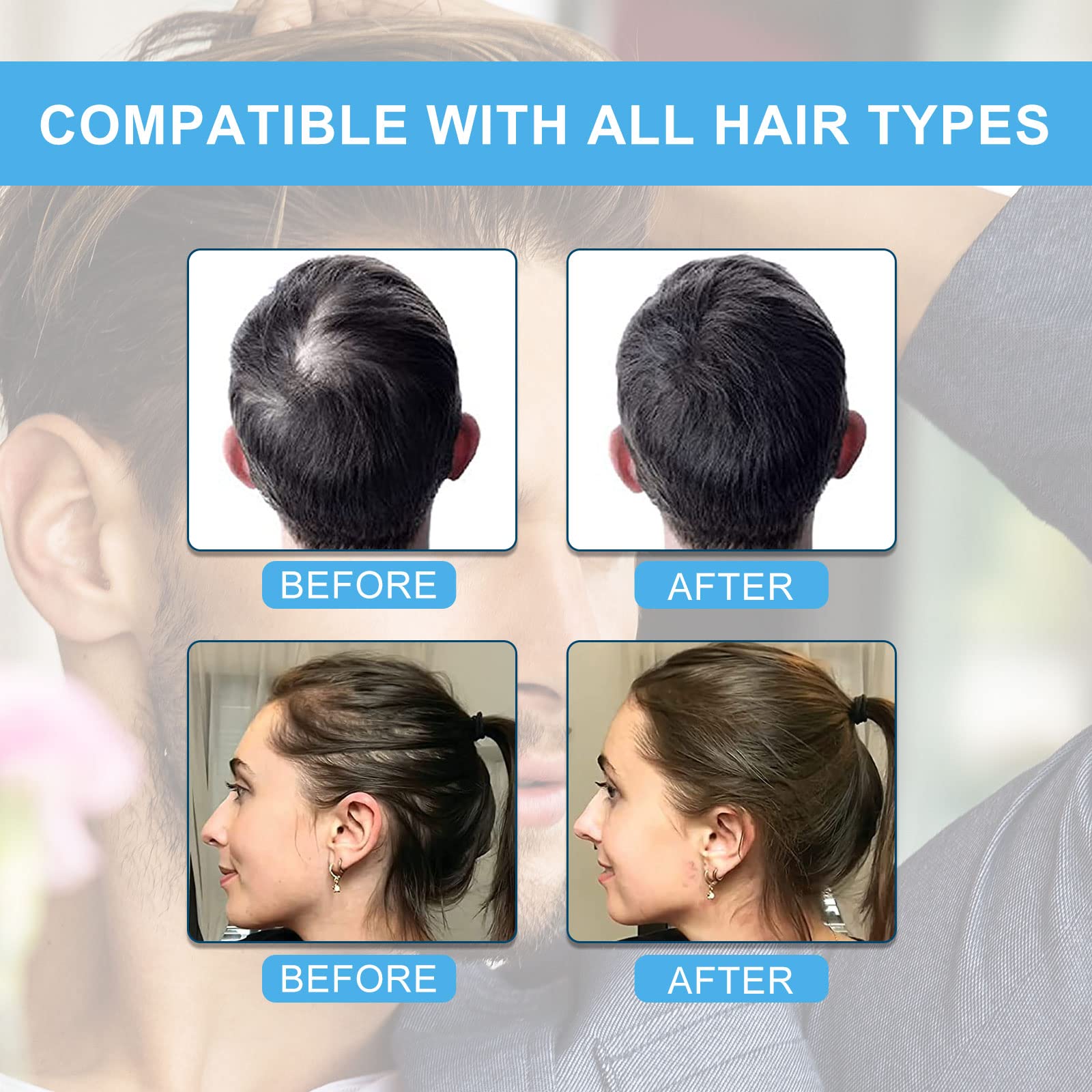 SHIFAKOU Hair Building Fibers - Black, 27.5g, Spray Applicator, Natural Look, Conceals Thinning Hair for Men & Women