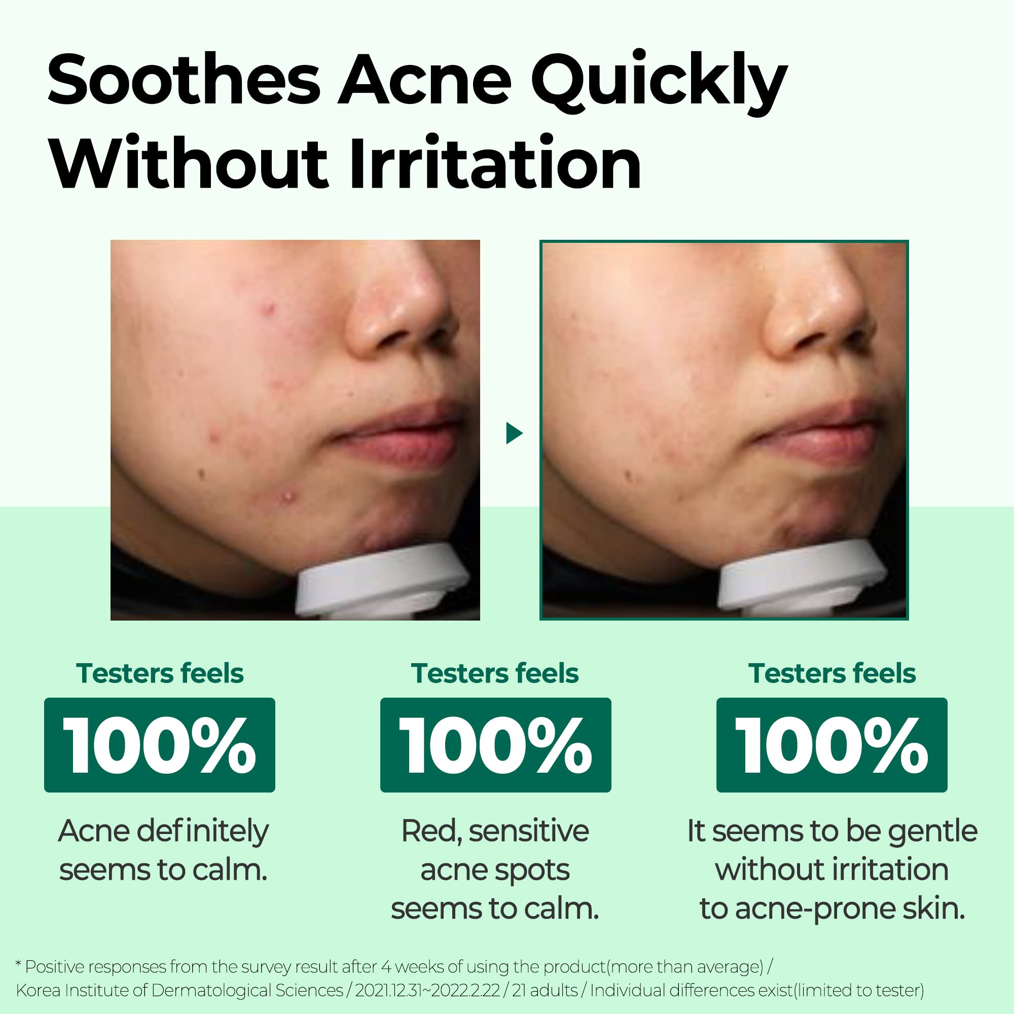 Some By Mi Aha Bha Pha 30 Days Miracle Cream - 202Oz, 60Ml - Made From Tea Tree Leaf Water For Sensitive Skin - Skin Calming And