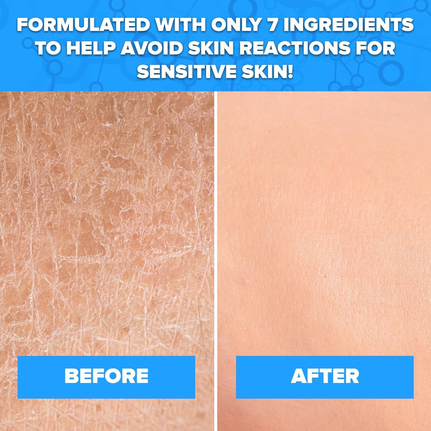 Aquanil Cleanser 16 Fl Oz - Pack of 4, Gentle Skin Cleansing Formula