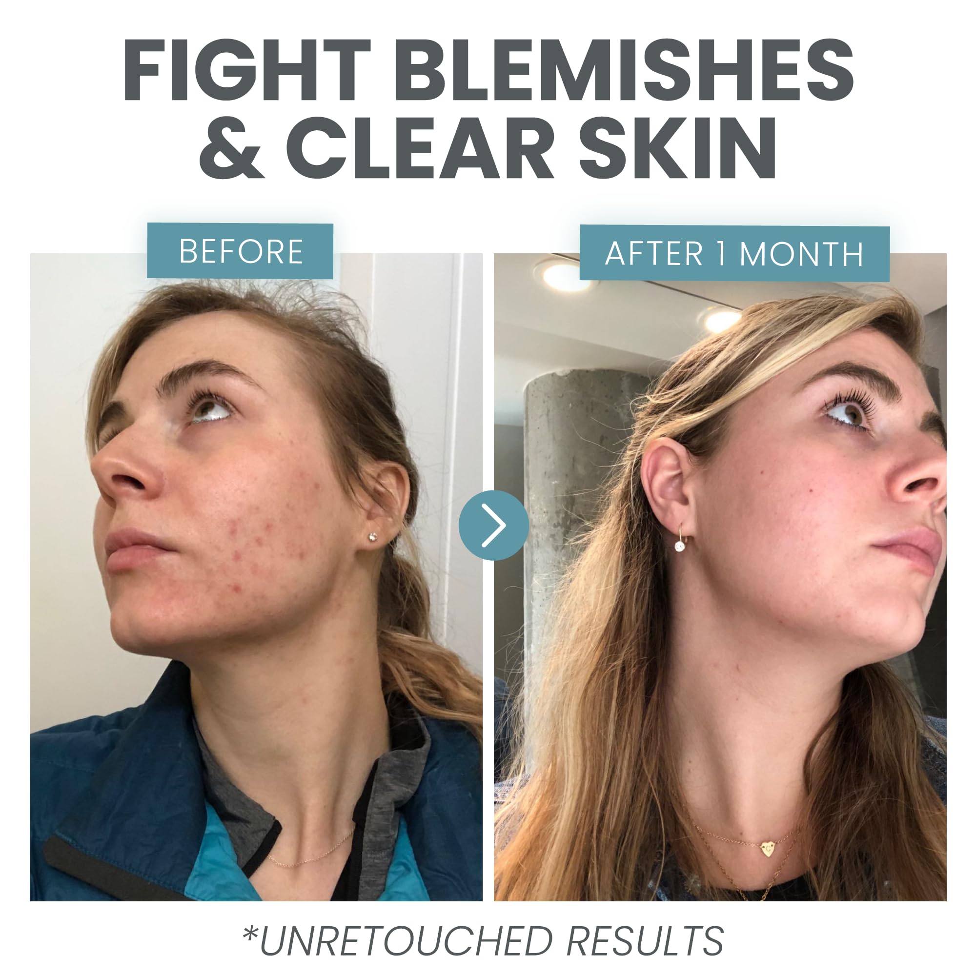 Vitamin C Serum For Face - Skin Clearing Serum With Salicylic Acid Retinol, Niacinamide And Hyaluronic Acid - Skin Brightening A