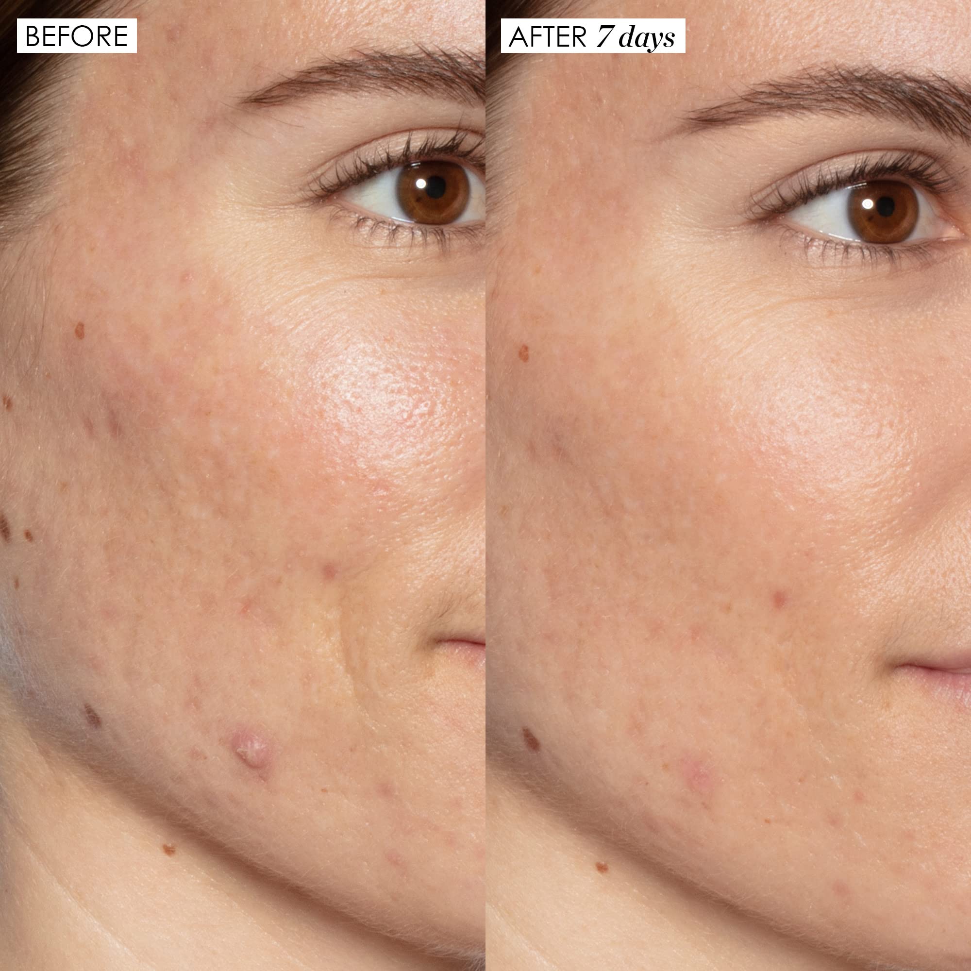 Sunday Riley Sunday GGL-15-US-FG Riley Good Genes All-In-One Lactic Acid Treatment Face Serum 0.5oz