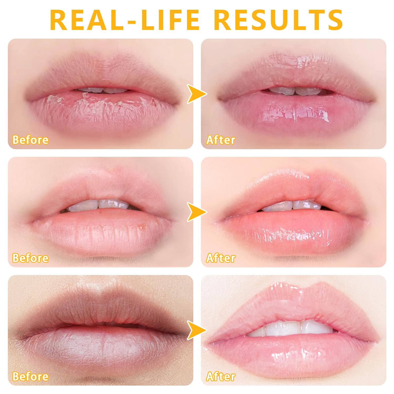 5 Pcs Bee Balm Lip Balm Lip Mask Honey Pot, Lip Mask Propolis Moisturizing Lip Balm, Hydrating Prevention Dry And Cracked Lip Sc