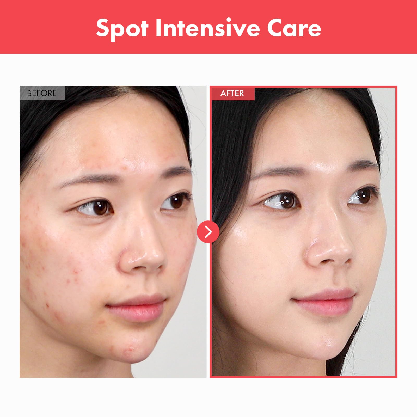 TOSOWOONG Ovalicin Skin Clear Cream, Skin Soothing, Moisturizing with Niacinamide and Sulfur, Korean Skincare, 50g, 1.76 oz.