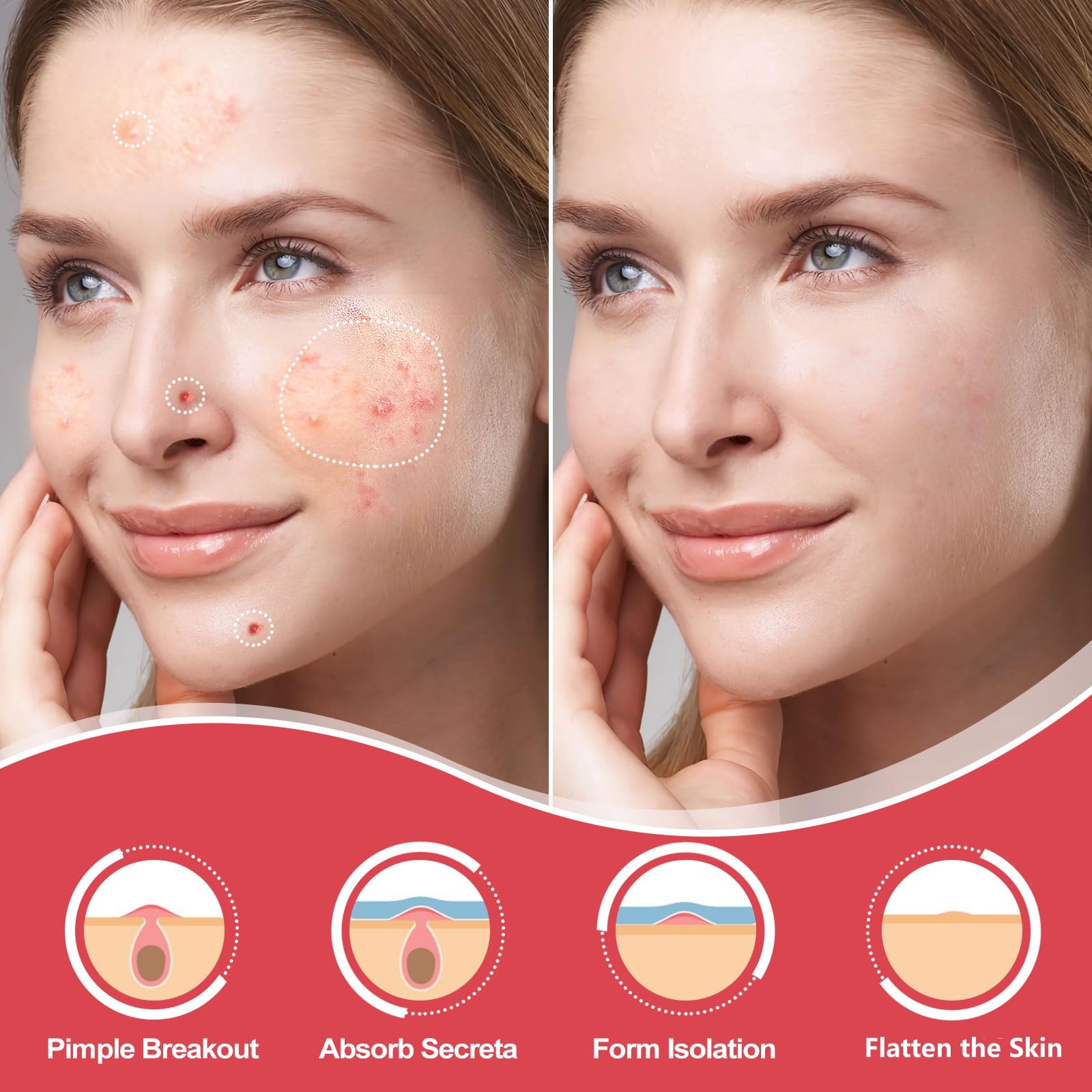 432 Counts Pimple Patches For Face, Hydrocolloid Acne Patches Zit Patches For Face Acne Spot Patch Cystic Acne