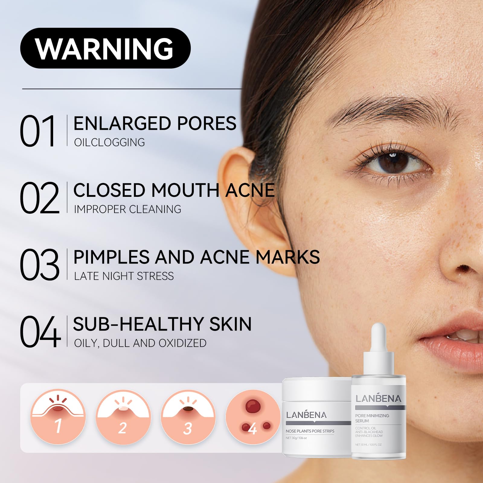 Lanbena 3-In-1 Blackhead Removal Set - Pore Strips (30G), Pore Minimizing Serum (30Ml) & Removal Paper - Mask For Face, Minimize