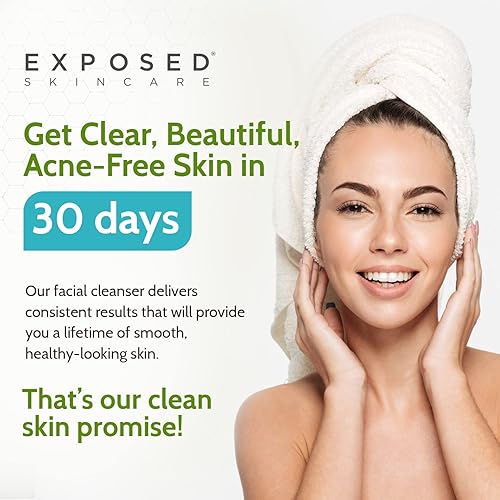 Exposed Skin Care Acne Facial Cleanser - Gentle Face Wash With Salicylic Acid For Acne Prone Skin - Pore Clarifying Acne Treatme