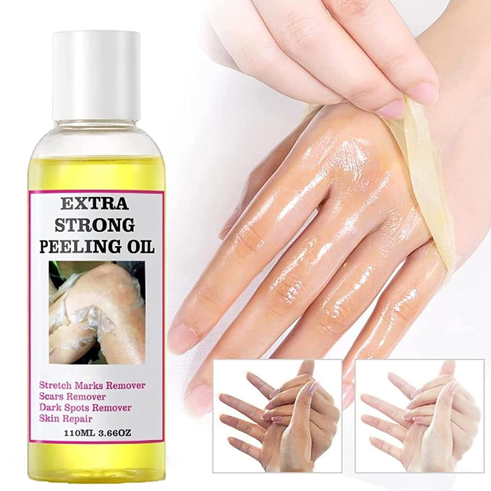 Generic Peeling Oil, Extra Strong Peeling Oil, Yellow Peeling Oil For Dark Skin, Exfoliating Peeling Solution For Body, Hand, Fe