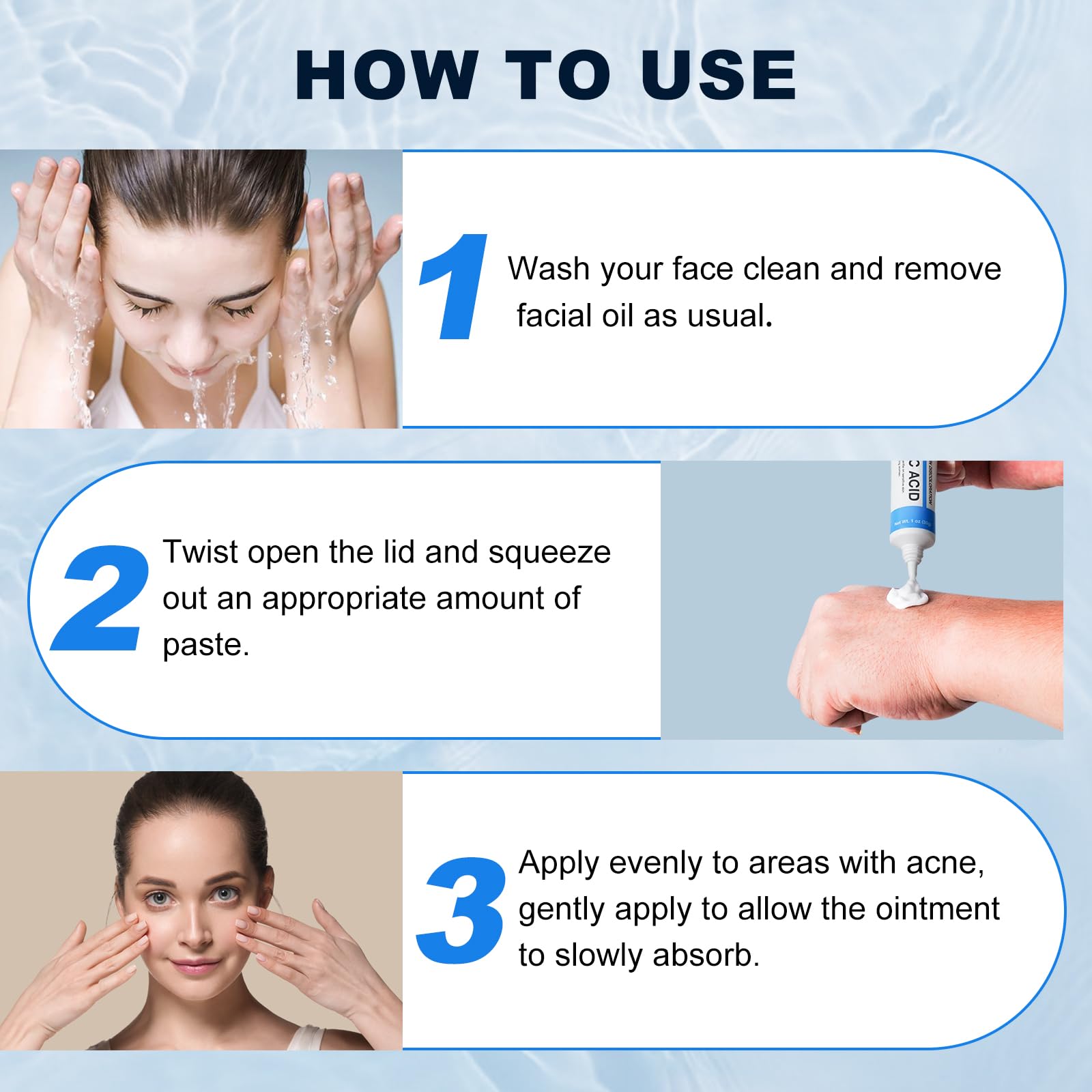 Azelaic Acid 10% Cream for Face - Acne Cream for Rosacea Reducing Relief Pimple Breakouts Blackhead Pigmentation and Redness - A