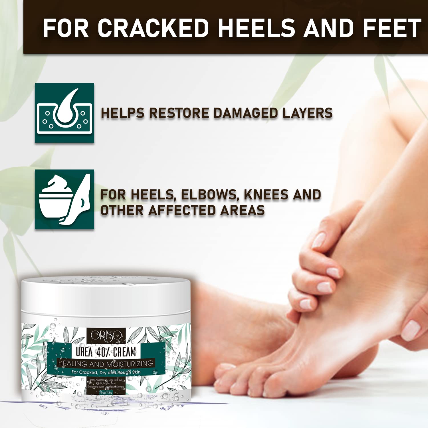 Urea Cream 40 Percent - Intensive Hydration for Dry and Cracked Heels, Feet, Hands, Elbows and Knees - Callus Remover for Women