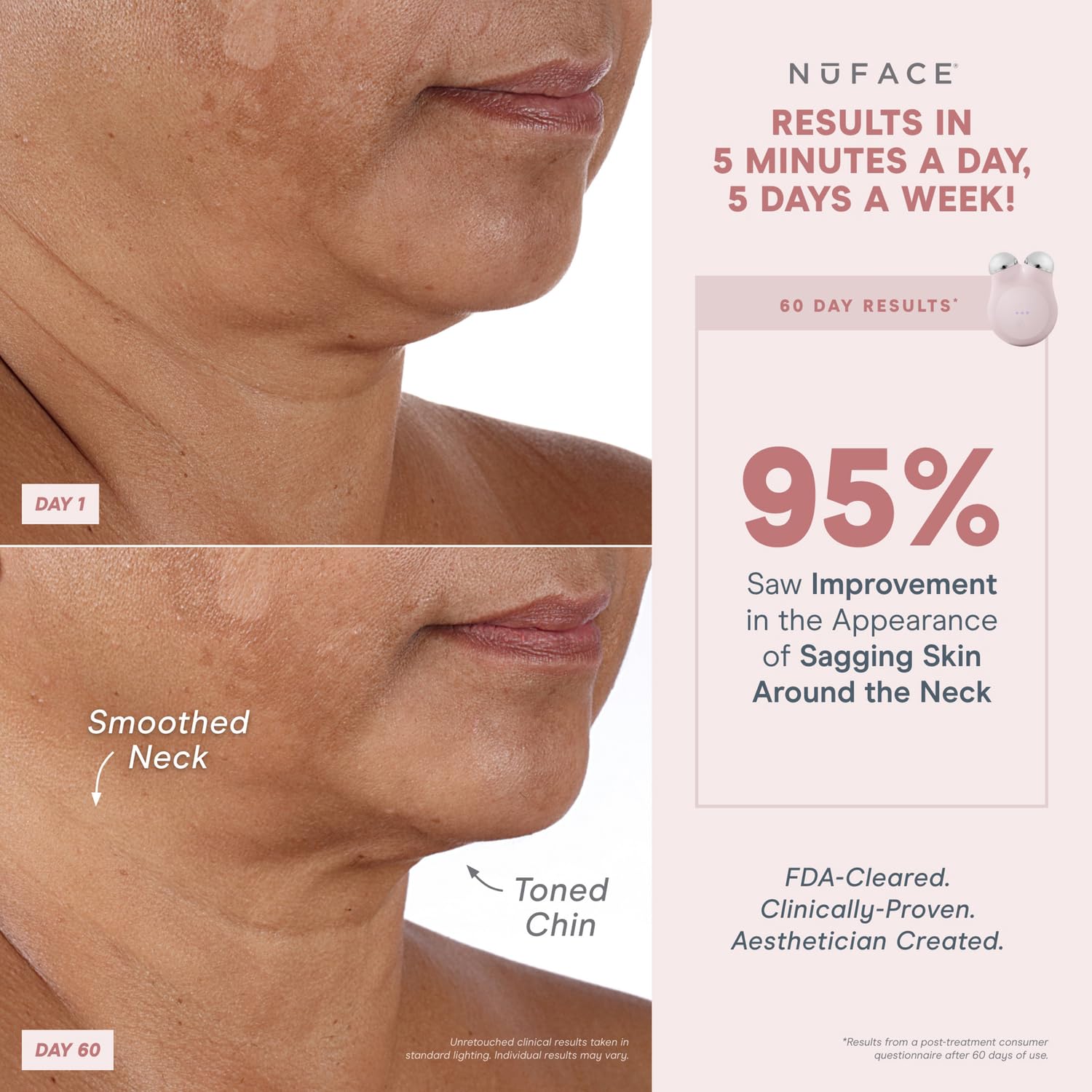 Nuface Mini+ Microcurrent Facial Device Kit - Fda Cleared Face Sculpting & Skin Tightening Device To Contour, Lift & Tone + Micr