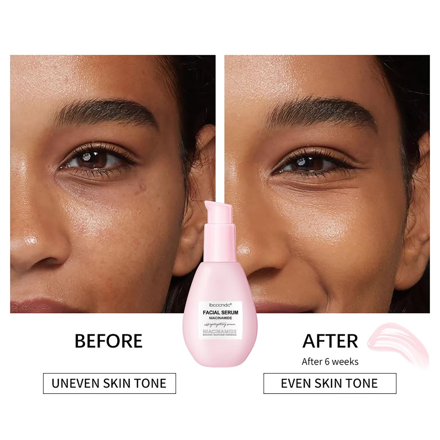 75Ml Watermelon Niacinamide Serum, Watermelon Hydrating Serum With Hyaluronic Acid,Brighten Moisturizing,Lightweight Watermelon