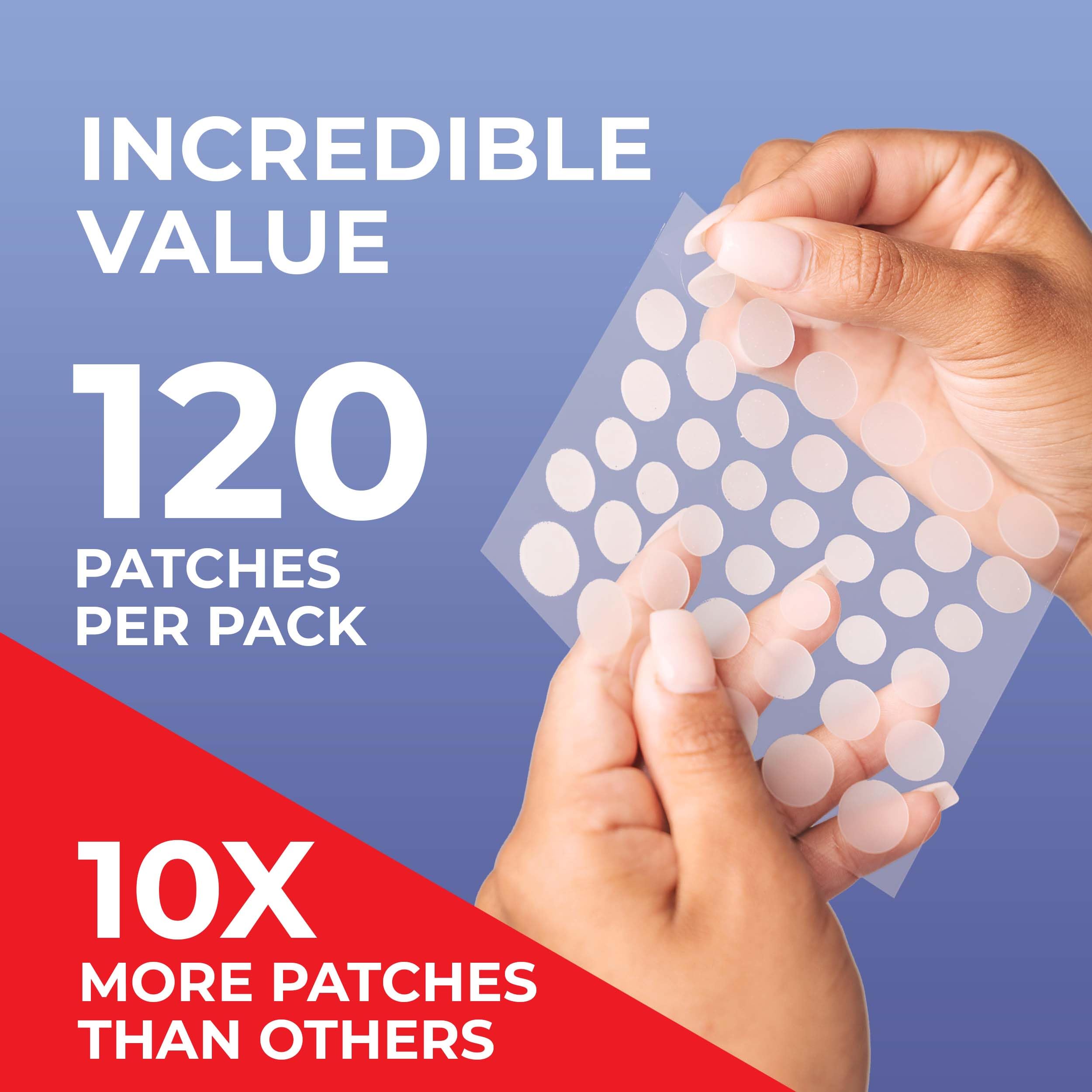 KEYCONCEPTS Pimple Patches (120 Pack), Salicylic Acid Acne Patches with Tea Tree Oil - Zit Patch and Pimple Stickers for Face -