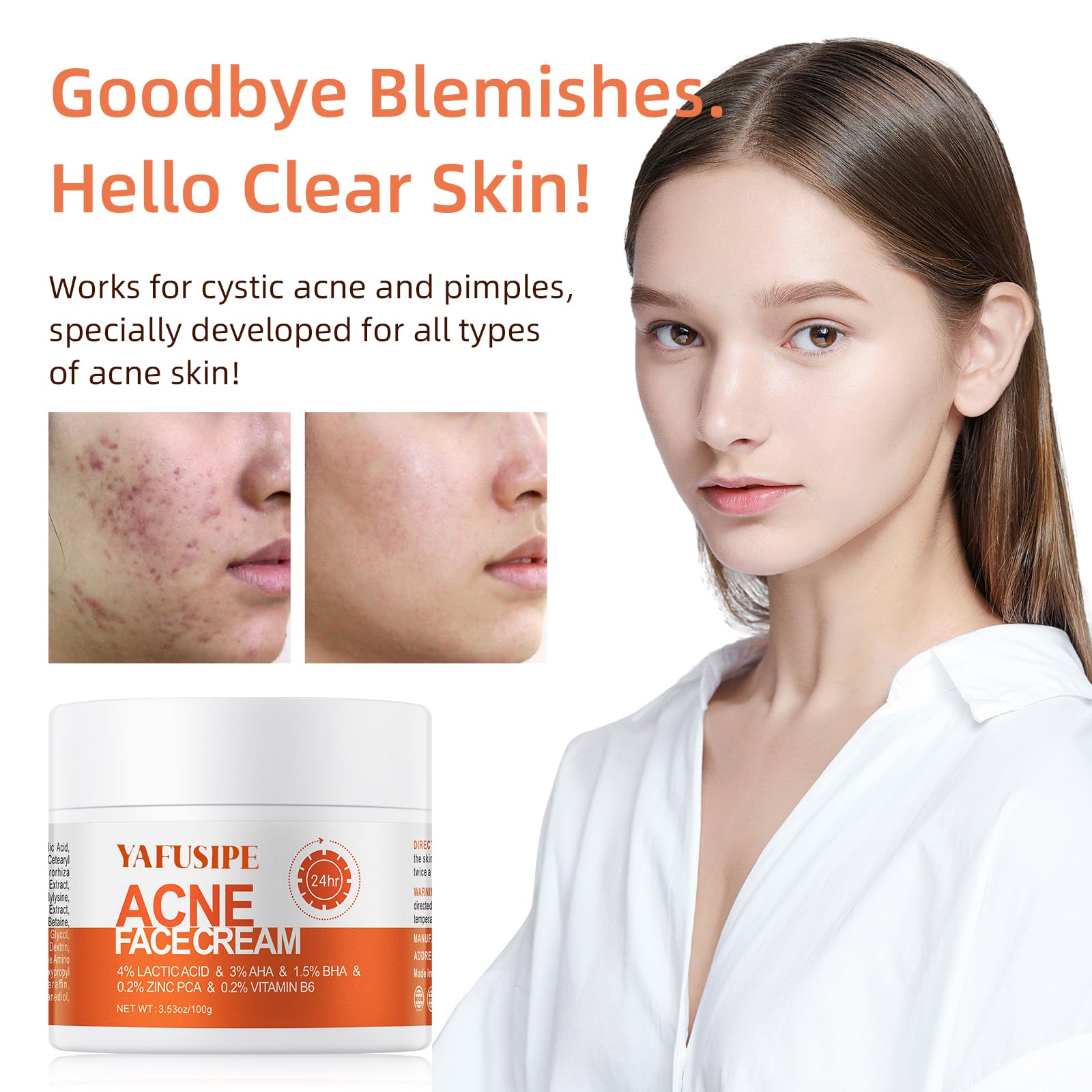 Acne Treatment for Face for Hormonal Cystic Stubborn Acne Cream for Sensitive Skin Teens Adults Women Men Spot Pimple Butt Contr