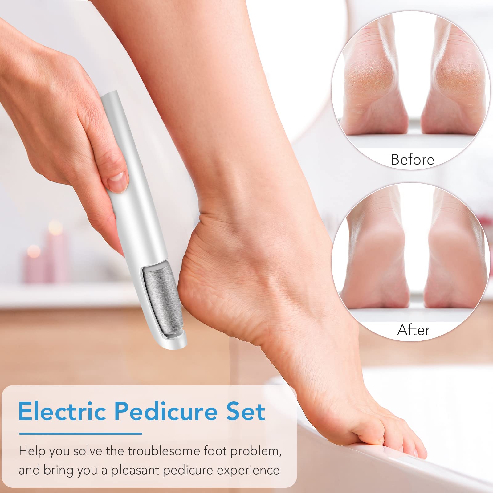 LINKEVAP Electric Callus Remover Kit - Professional Foot Scrubber for Dry Skin, 1 Count, Cold White, At Home Spa Care for Men & Women